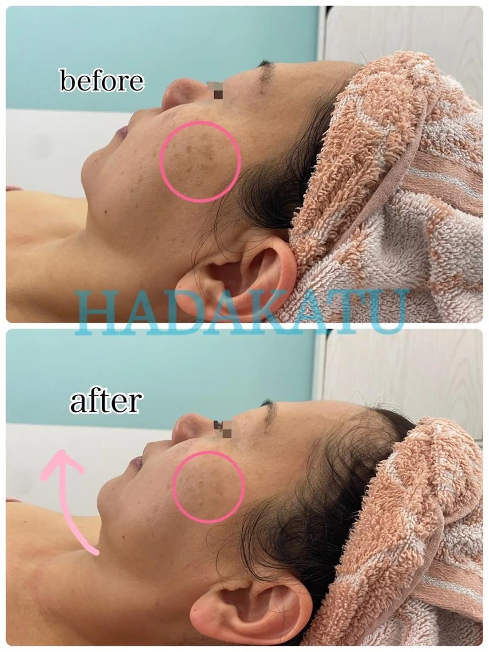 脱毛 総合エステサロン 肌活のエステ・リラクイメージ