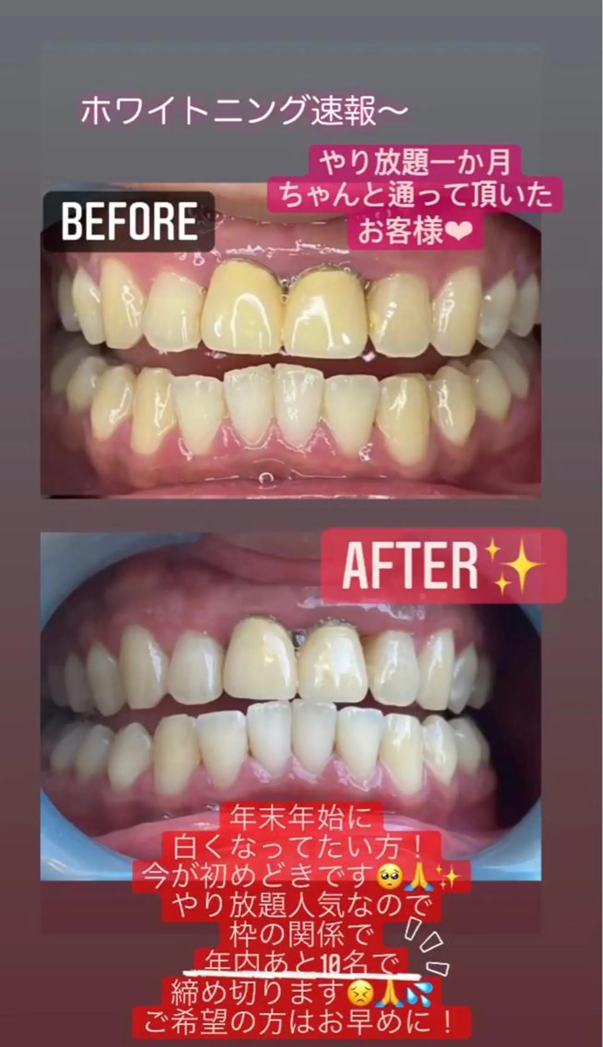 LAVISH nail salonのネイルデザイン