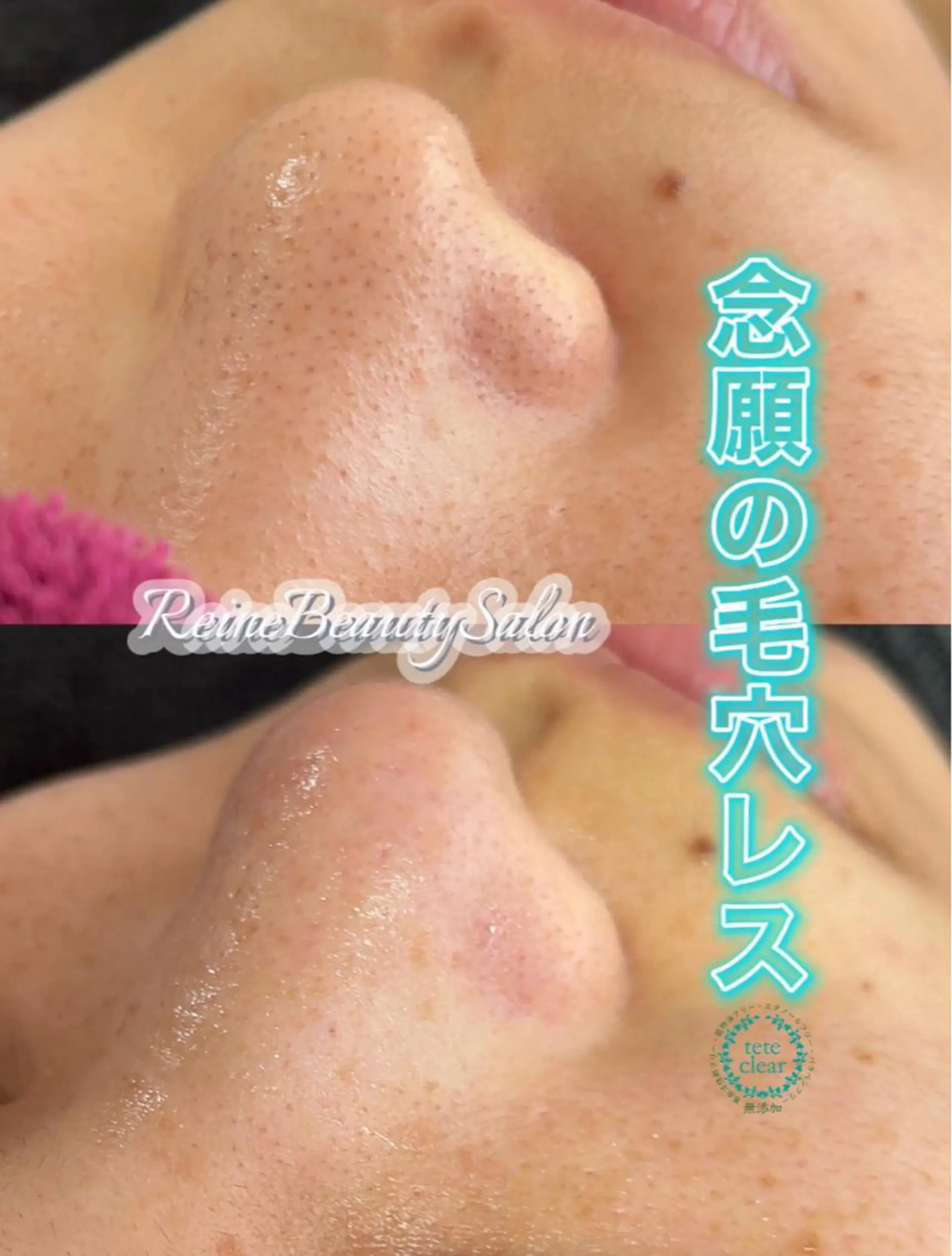 Reine BeautySalon所属・毛穴/シミ肝斑/脱毛 横山梨里のエステ・リラクイメージ