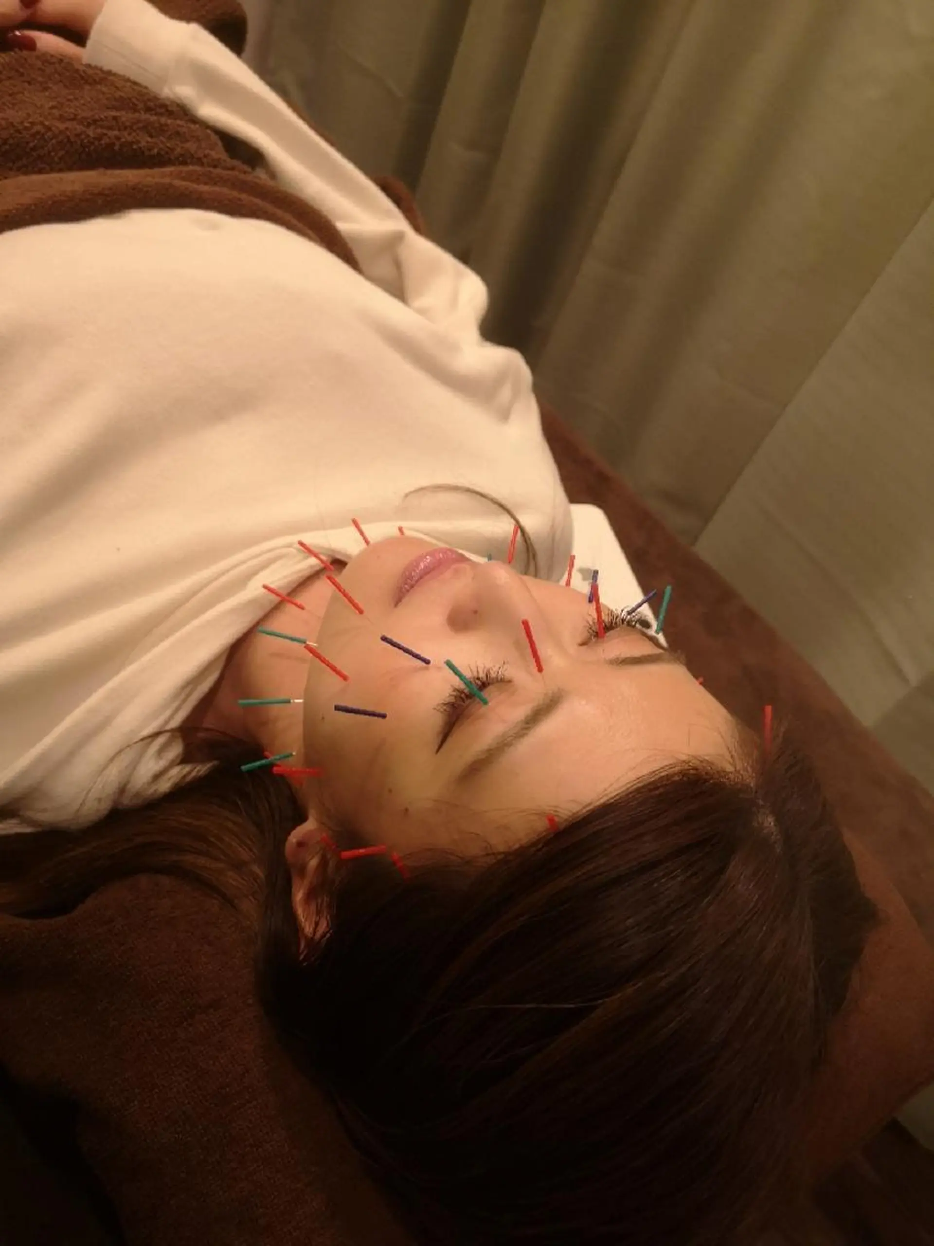 たるみ専門美容鍼 × 猫背整体 のぐち所属・小顔と姿勢改善のプロ ｜整体と美容鍼のぐちのエステ・リラクイメージ