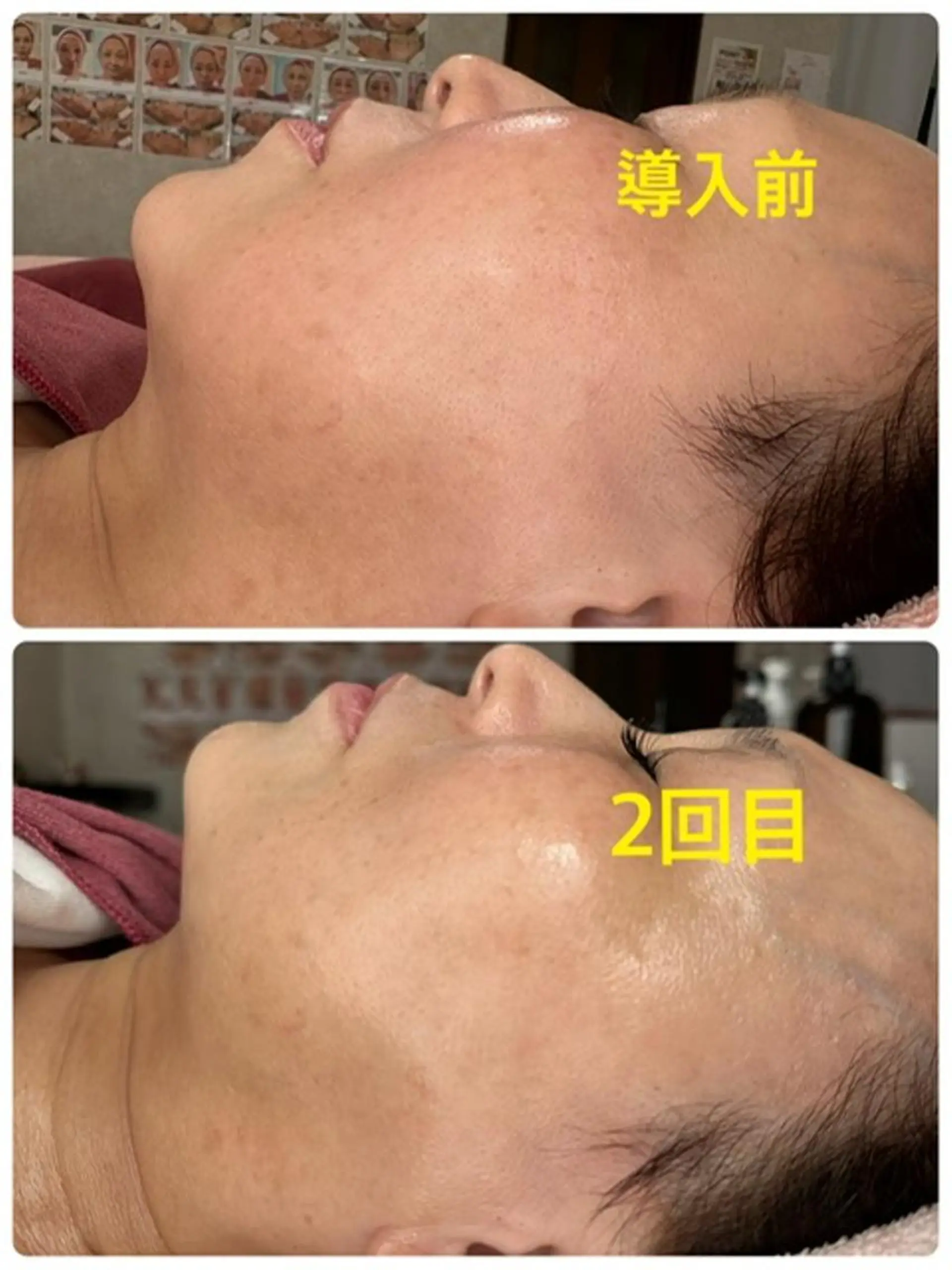 Lien オーナー 山口智嘉のエステ・リラクイメージ