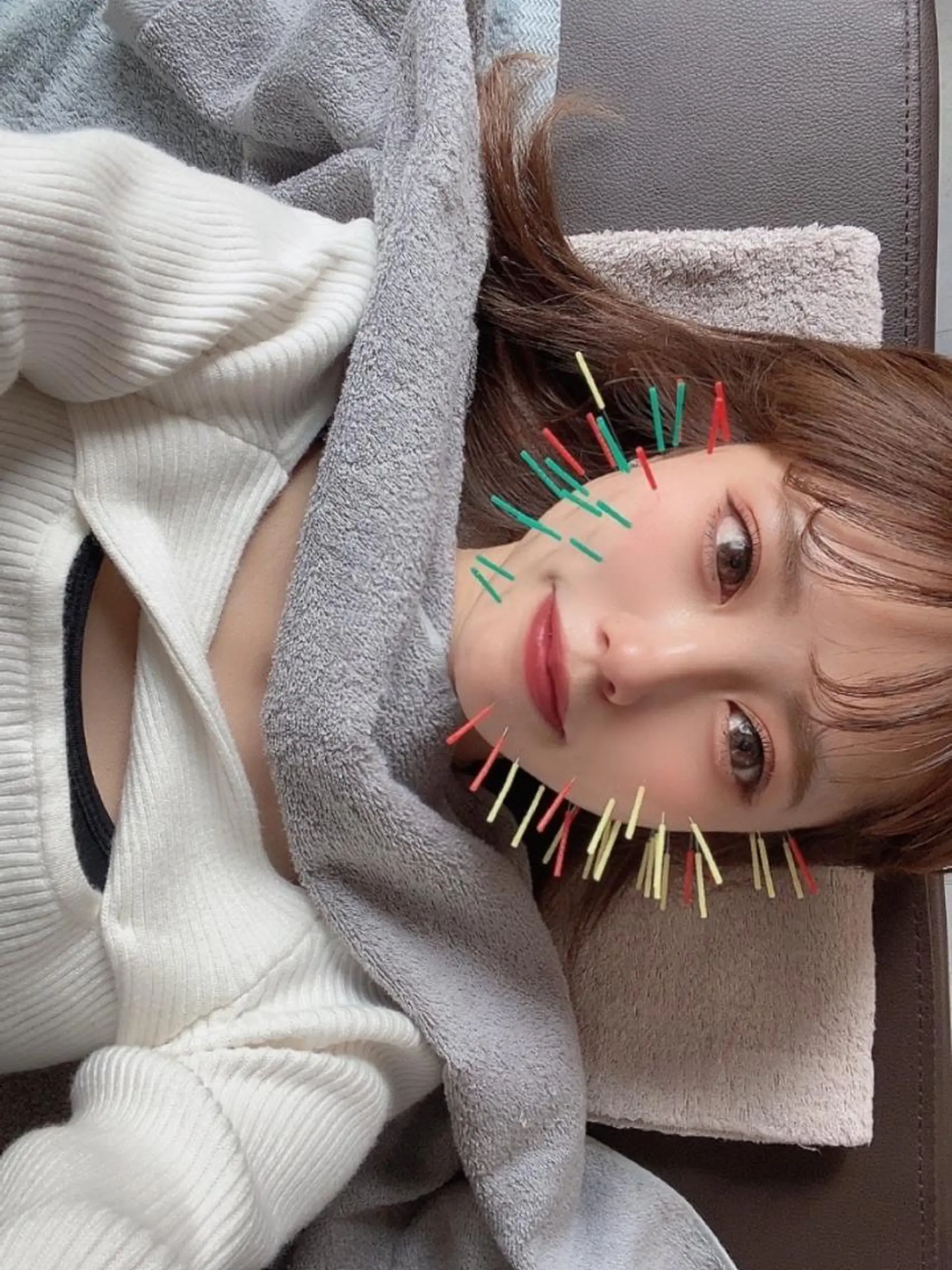 鍼灸整骨院Refine所属・鍼灸 Refineのその他イメージ