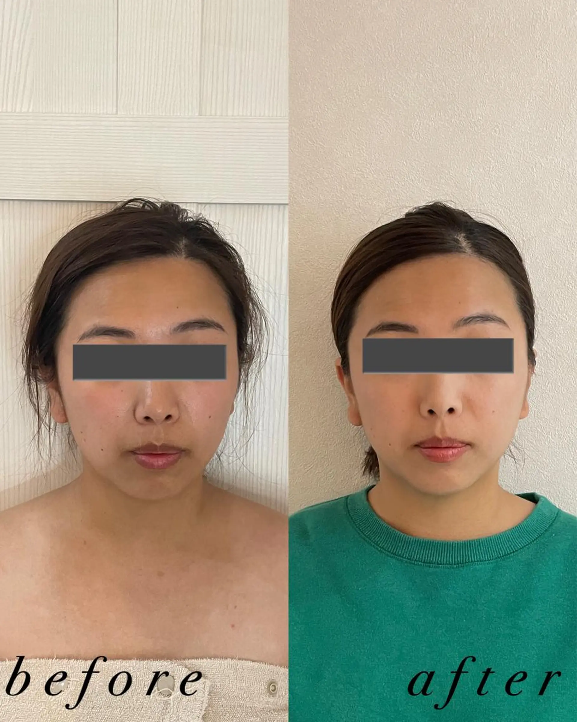 うなじ脱毛/美肌脱毛 LABELのエステ・リラクイメージ