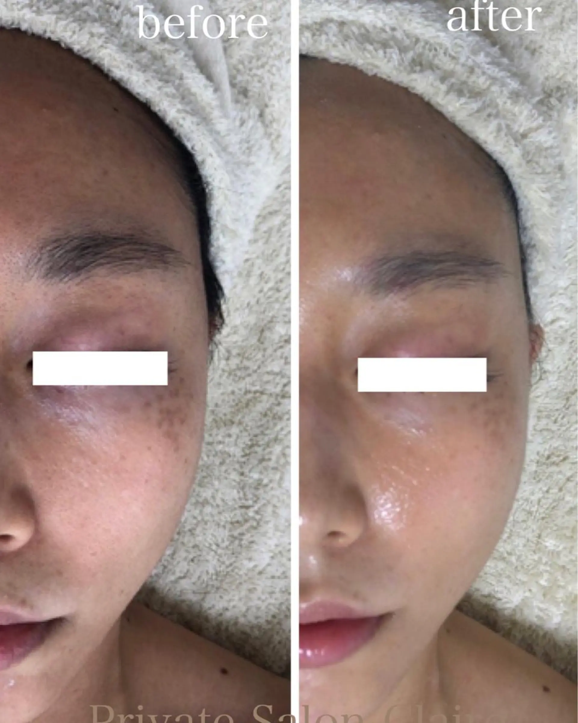 体の中から肌質改善 クレール　奈良のエステ・リラクイメージ