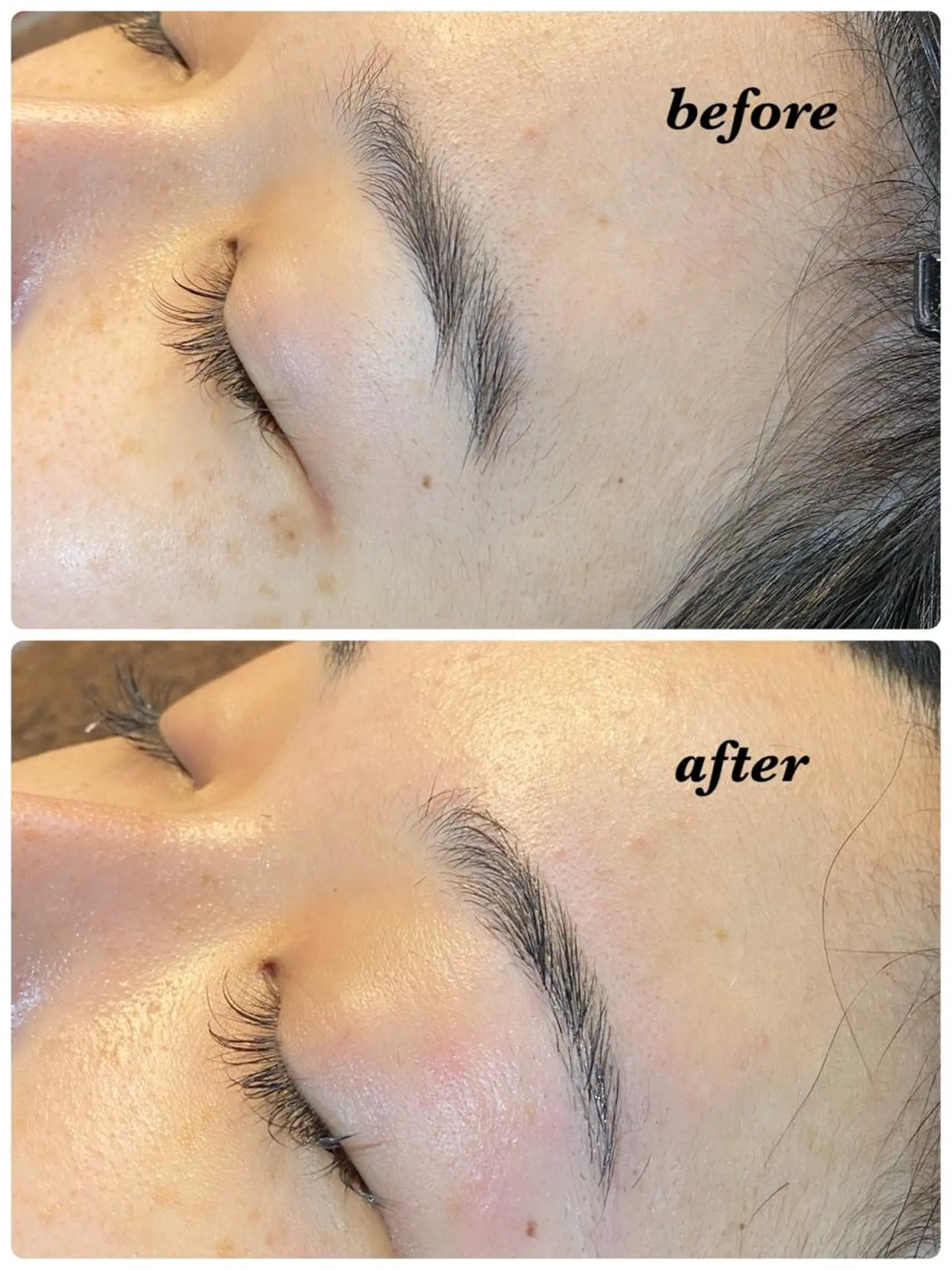 アイブロウ ハーブピーリング/韓国肌管理/フェイシャル/毛穴洗浄/眉毛/顔脱毛【糸脱毛専門】rev所属・ハーブピーリング🌹 毛穴洗浄❤️眉waxのエステ・リラクイメージ