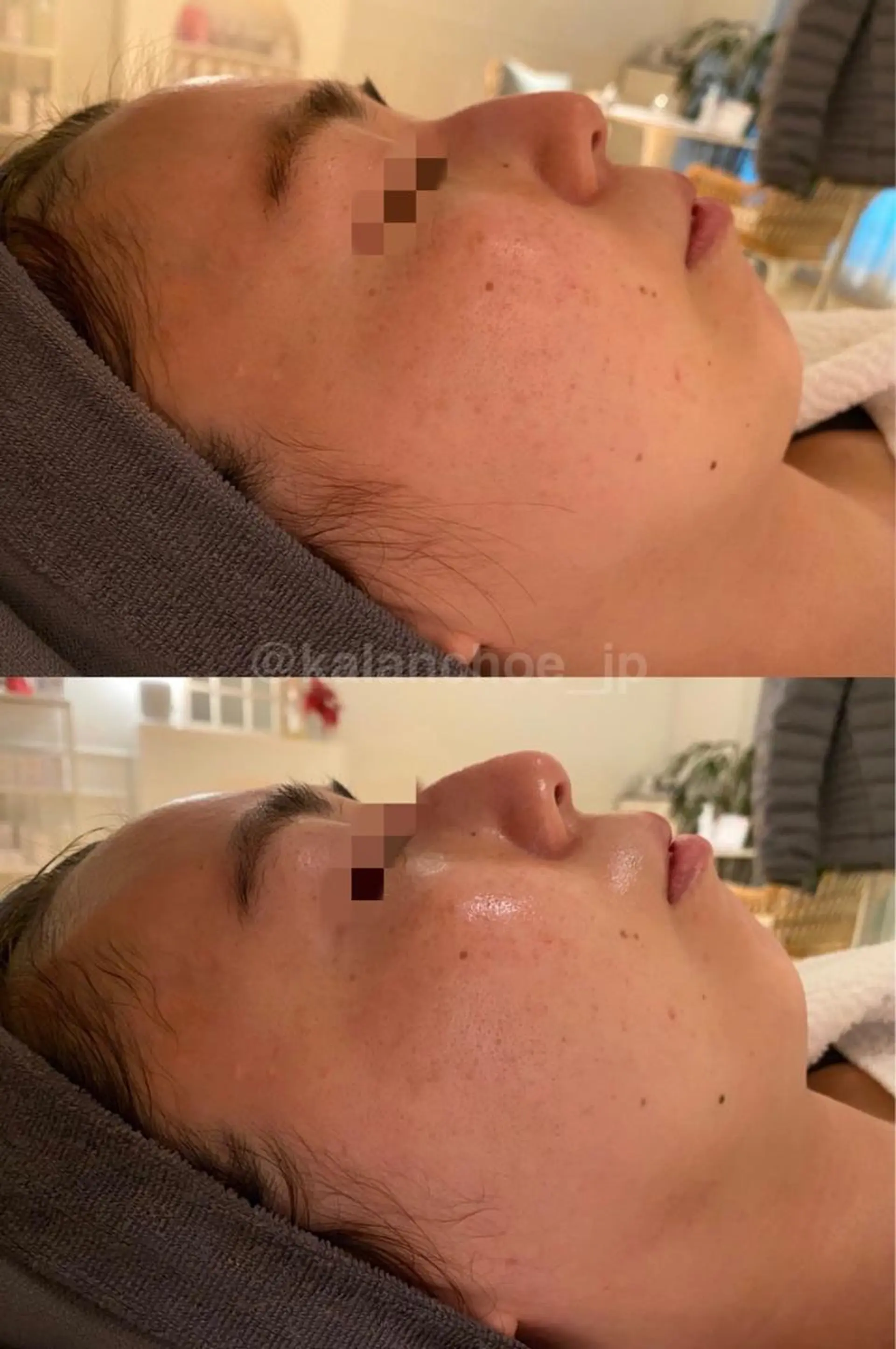 肌質改善 KALANCHOEのエステ・リラクイメージ