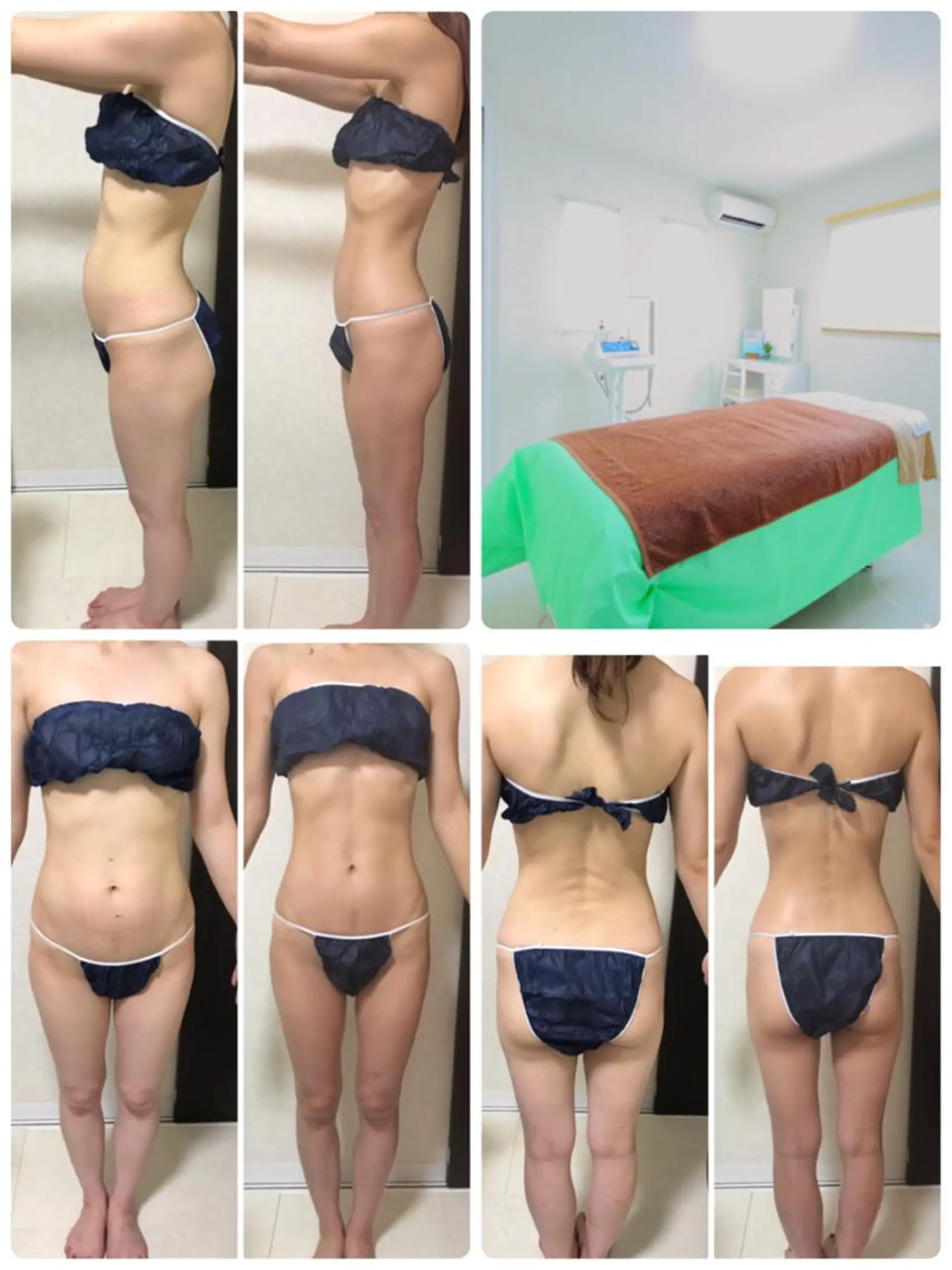 その他 ダイエット／脱毛 美顔／フォト／ハーブのその他イメージ