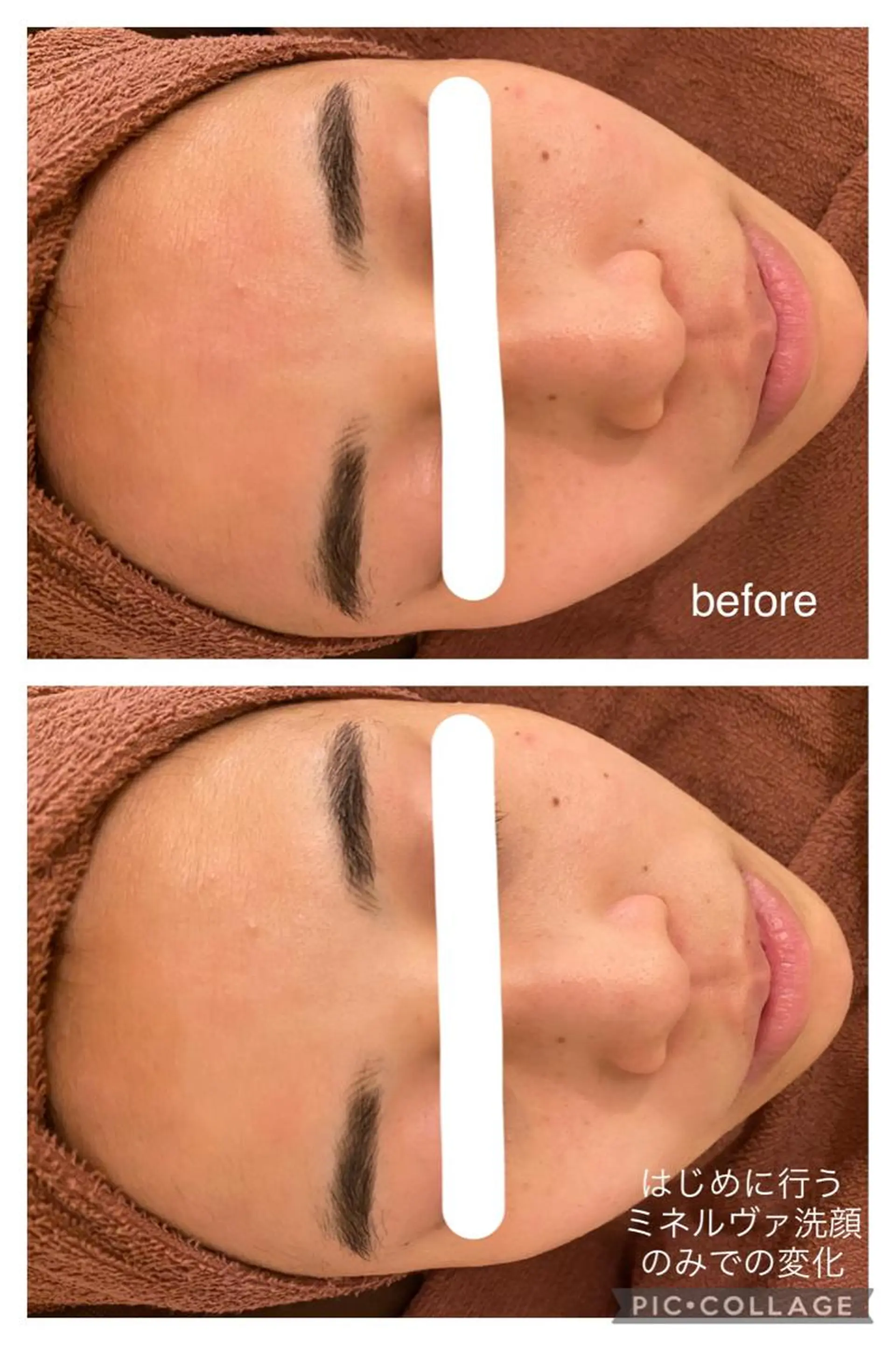 夏までに肌荒れ卒業 するサロン🌻のエステ・リラクイメージ