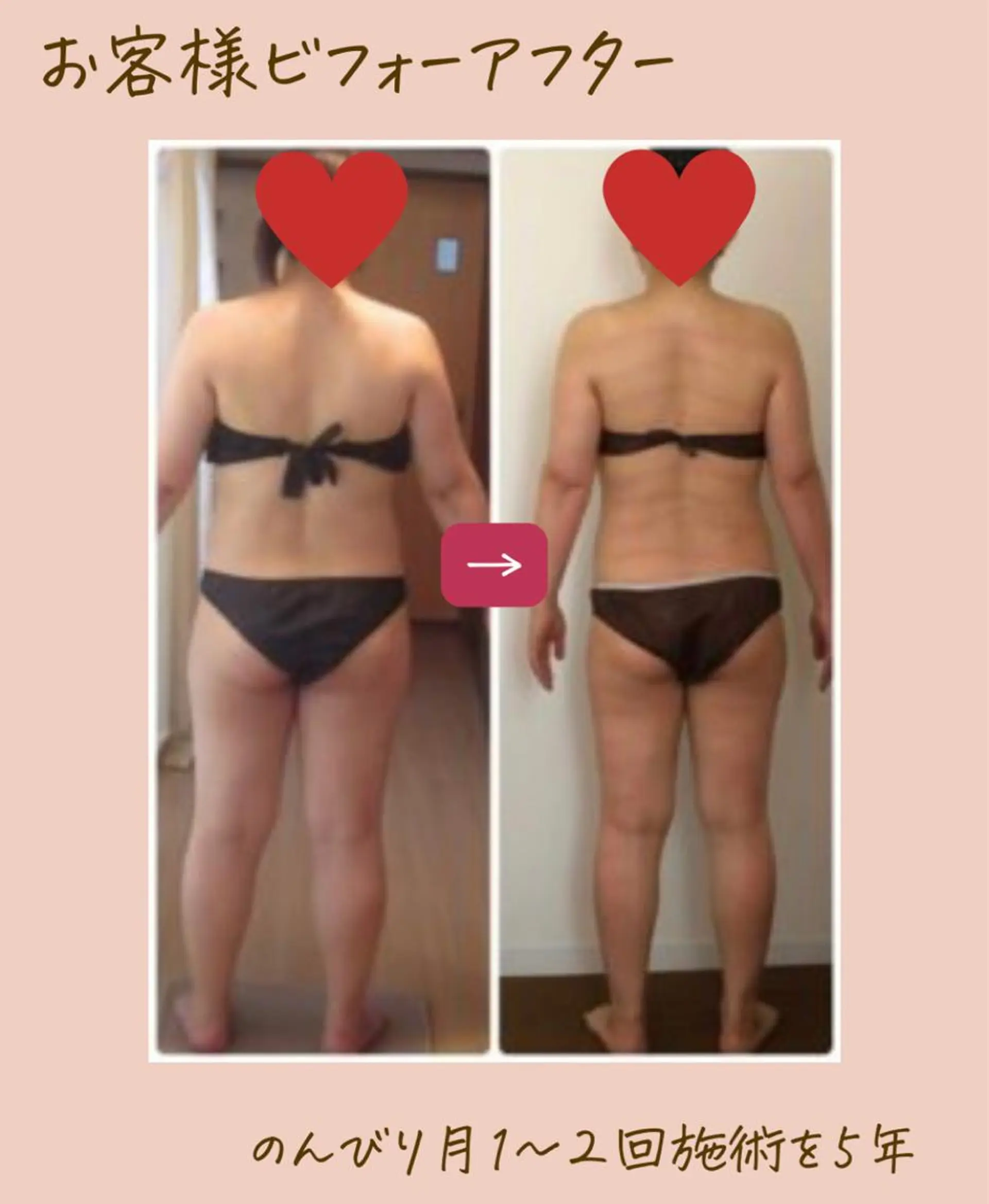 エステ エステサロンNerice所属・トロふわ愛され 美ボディNericeのエステ・リラクイメージ