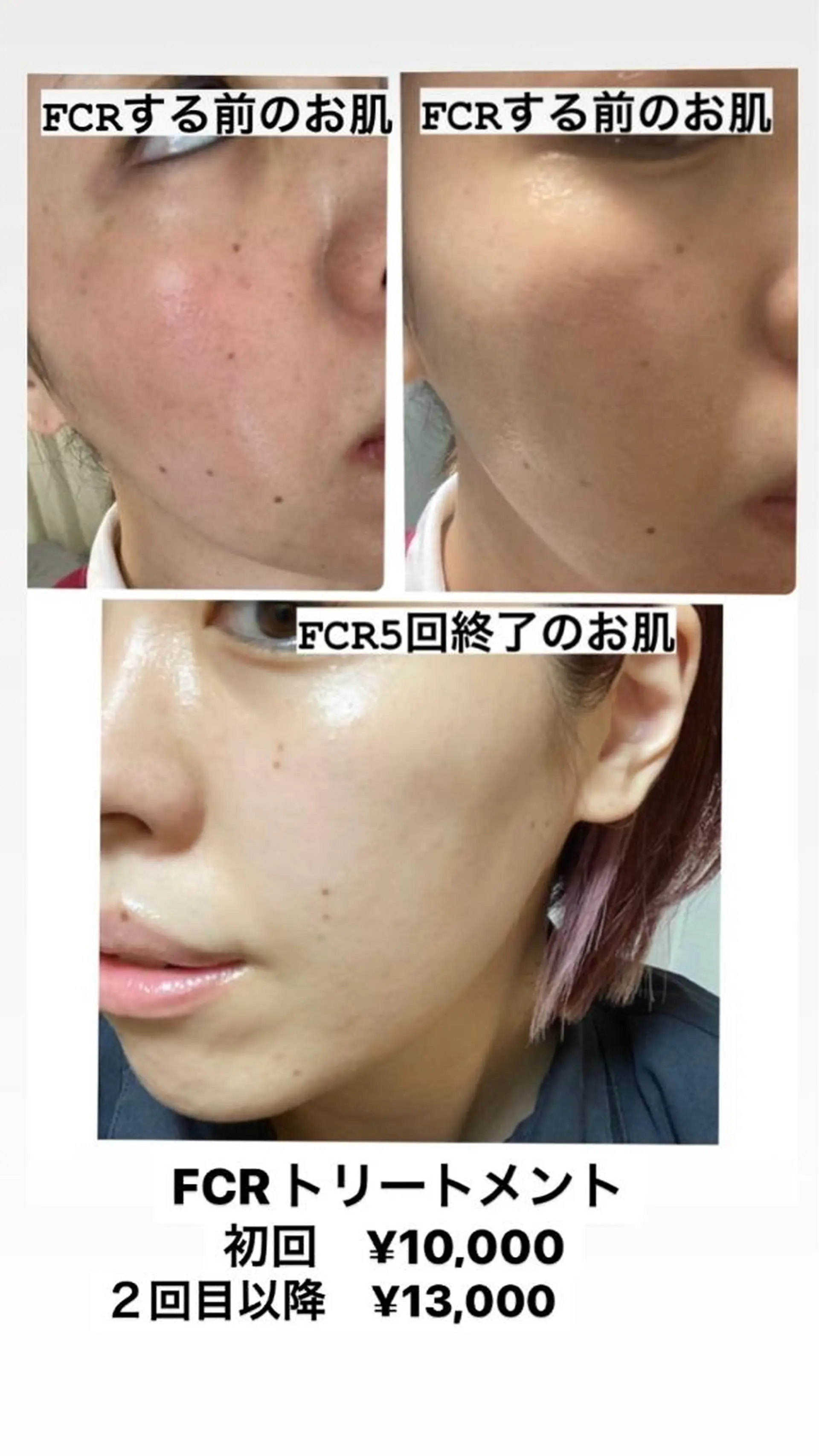 エステ 美顔秘密基地新宮所属・美顔秘密基地 新宮のその他イメージ