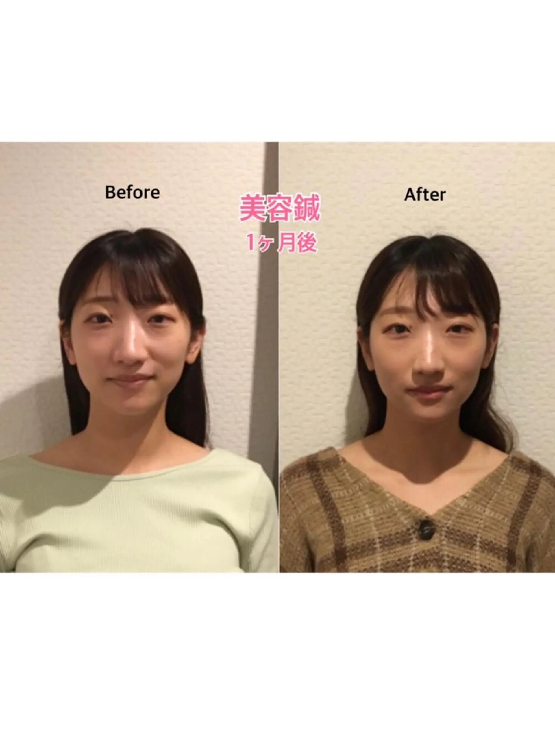 エステ チキバン美容鍼灸整体 サロン心斎橋店のエステ・リラクイメージ