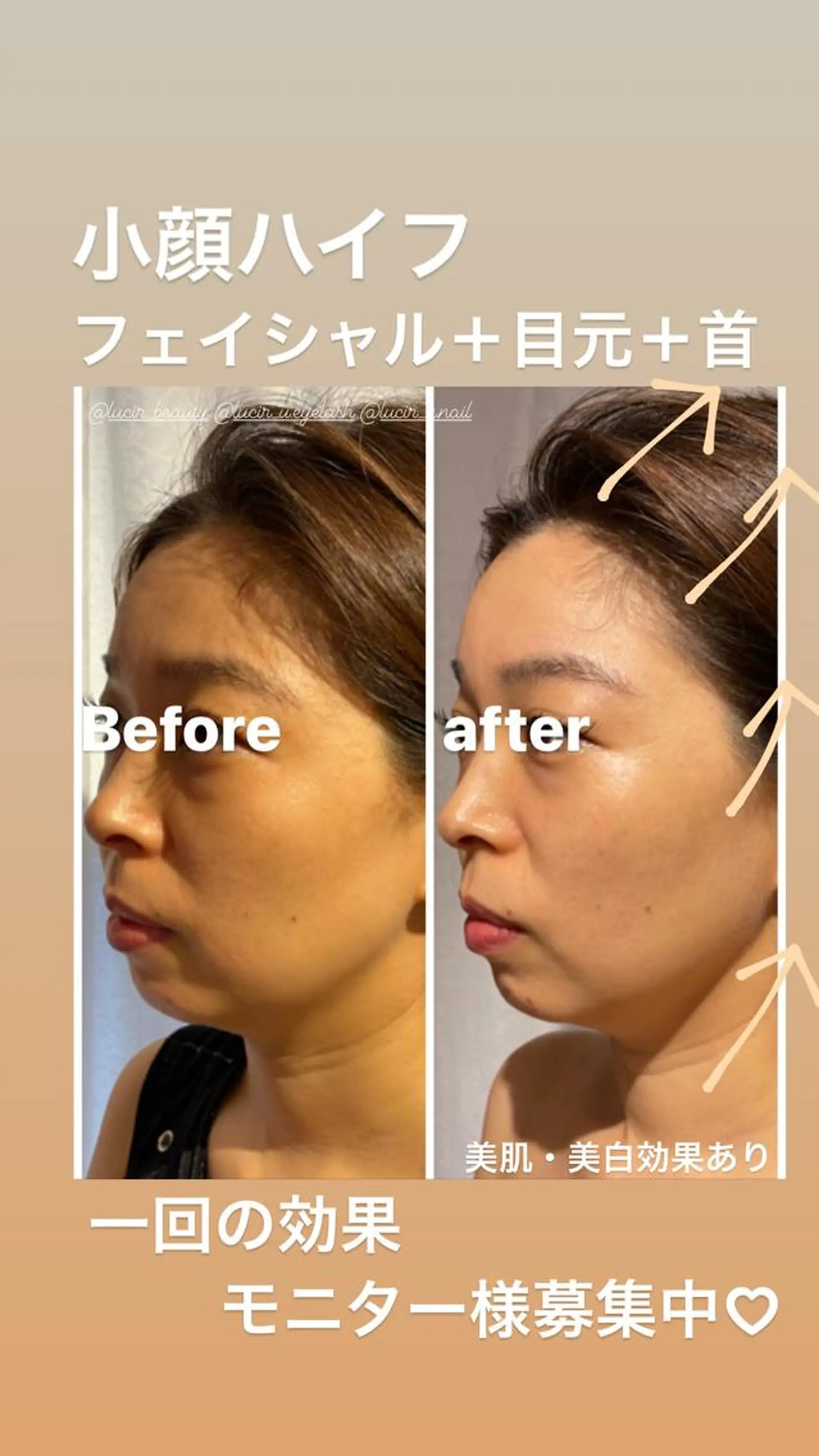 ミディアム カラー パーマ ヘアアレンジ メンズ キッズ ネイル マツエク・マツパ ルシール ユーのエステ・リラクイメージ