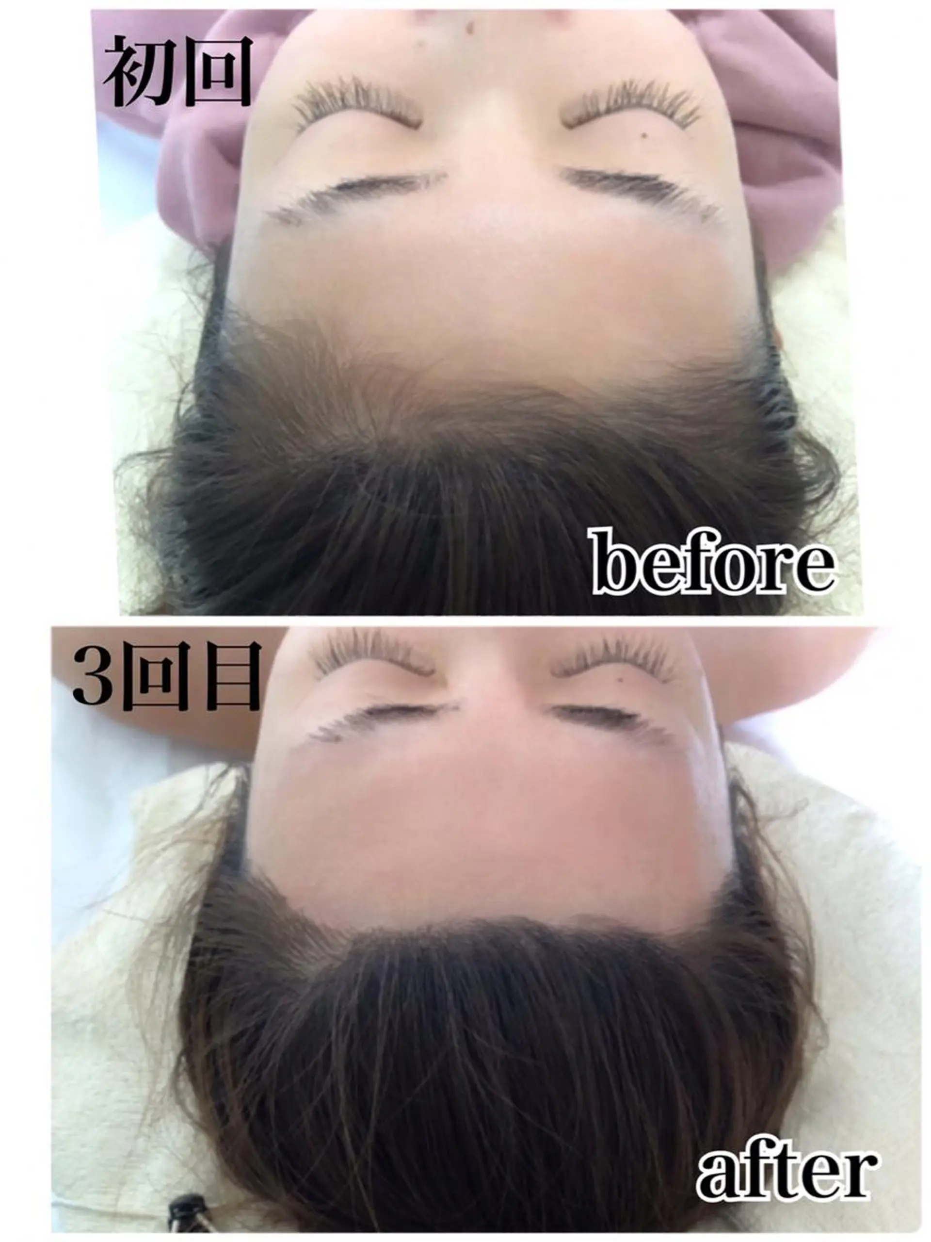 脱毛 nakao toshimiのエステ・リラクイメージ