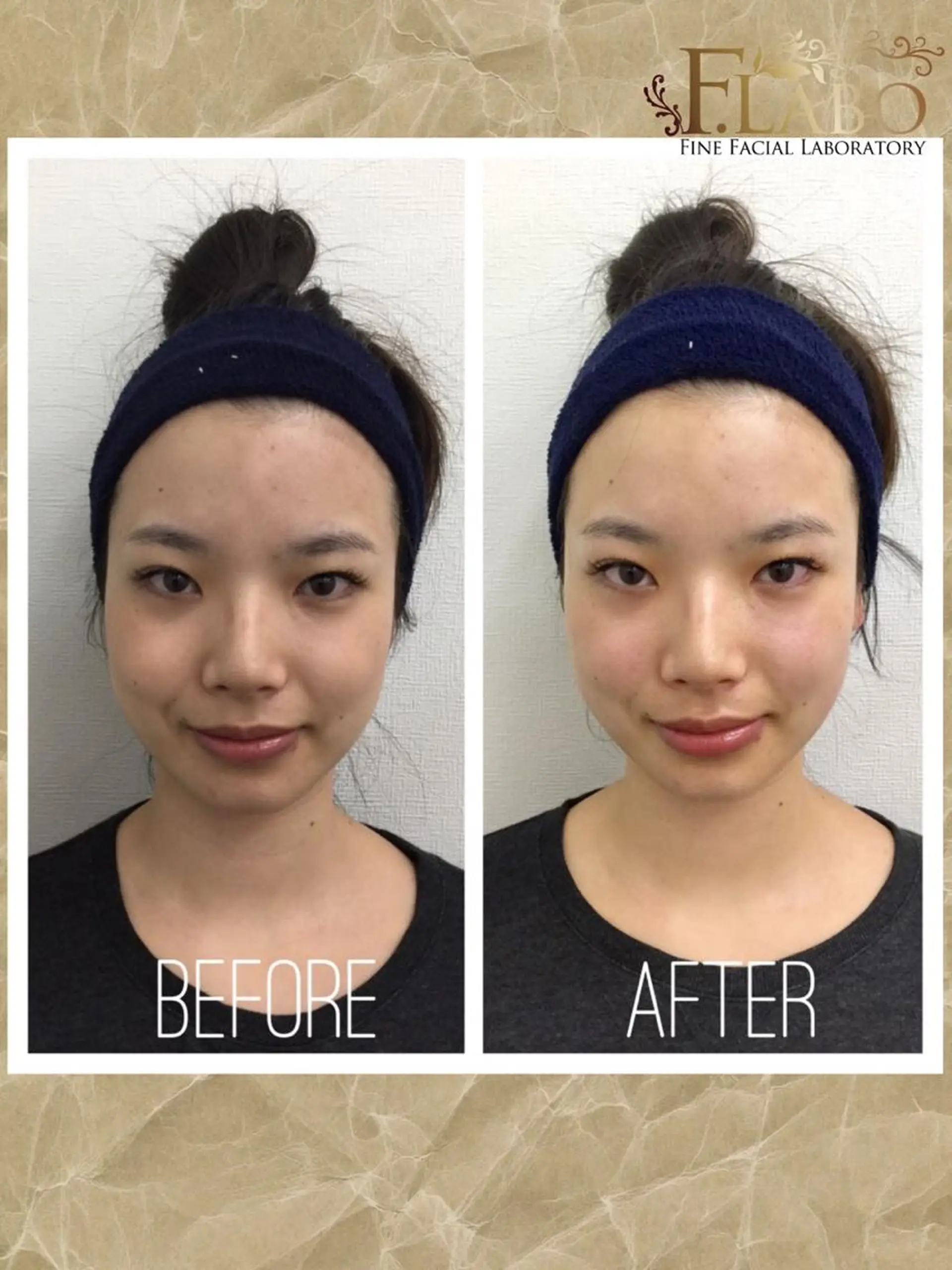 その他 小顔&ダイエットジム エステ担当REIKOのその他イメージ