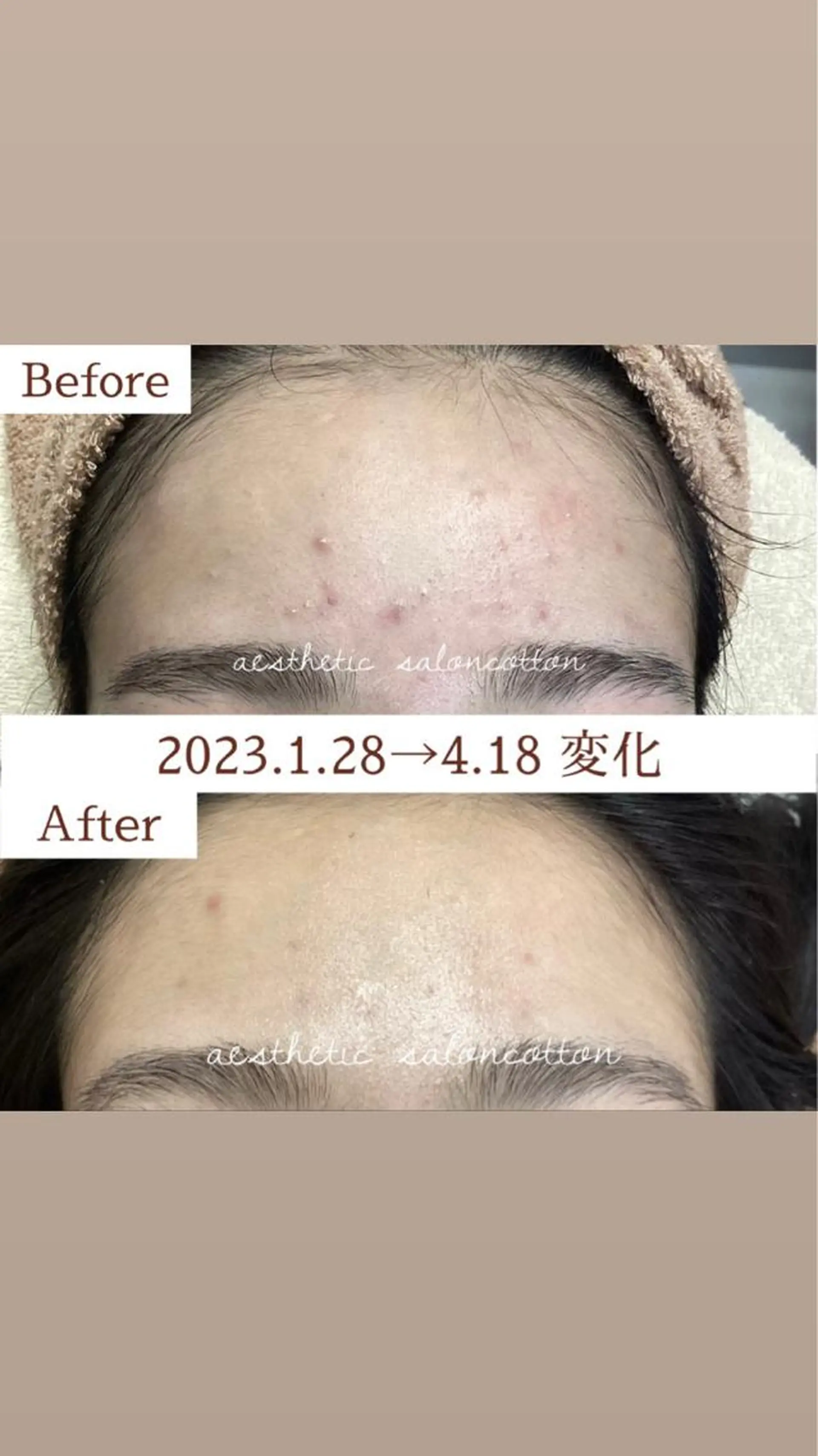 都度払い 肌質改善専門サロンのエステ・リラクイメージ