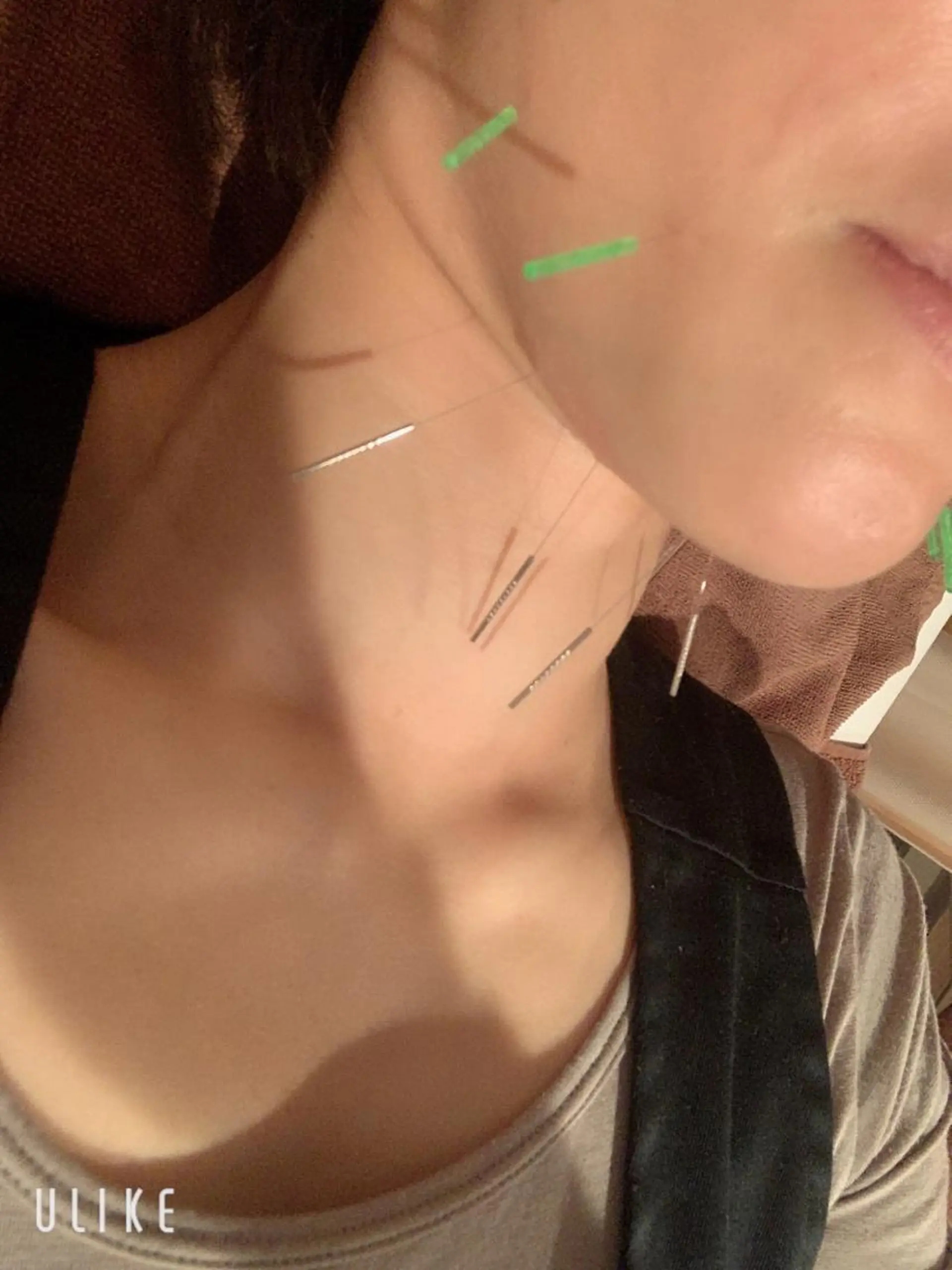 エステ リラク 美容鍼灸イロドリ  のエステ・リラクイメージ