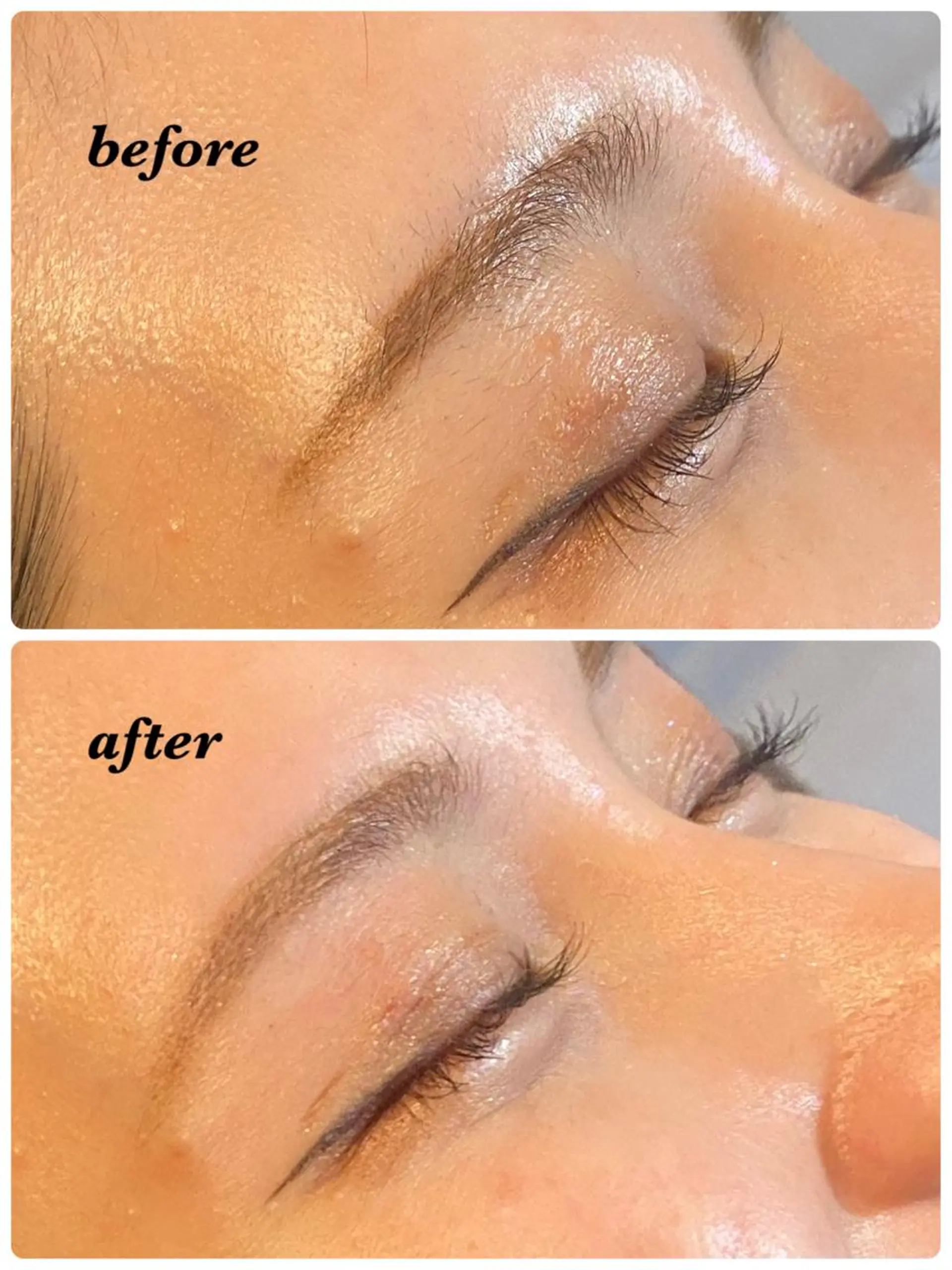 アイブロウ ハーブピーリング/韓国肌管理/フェイシャル/毛穴洗浄/眉毛/顔脱毛【糸脱毛専門】rev所属・ハーブピーリング🌹 毛穴洗浄❤️眉waxのエステ・リラクイメージ