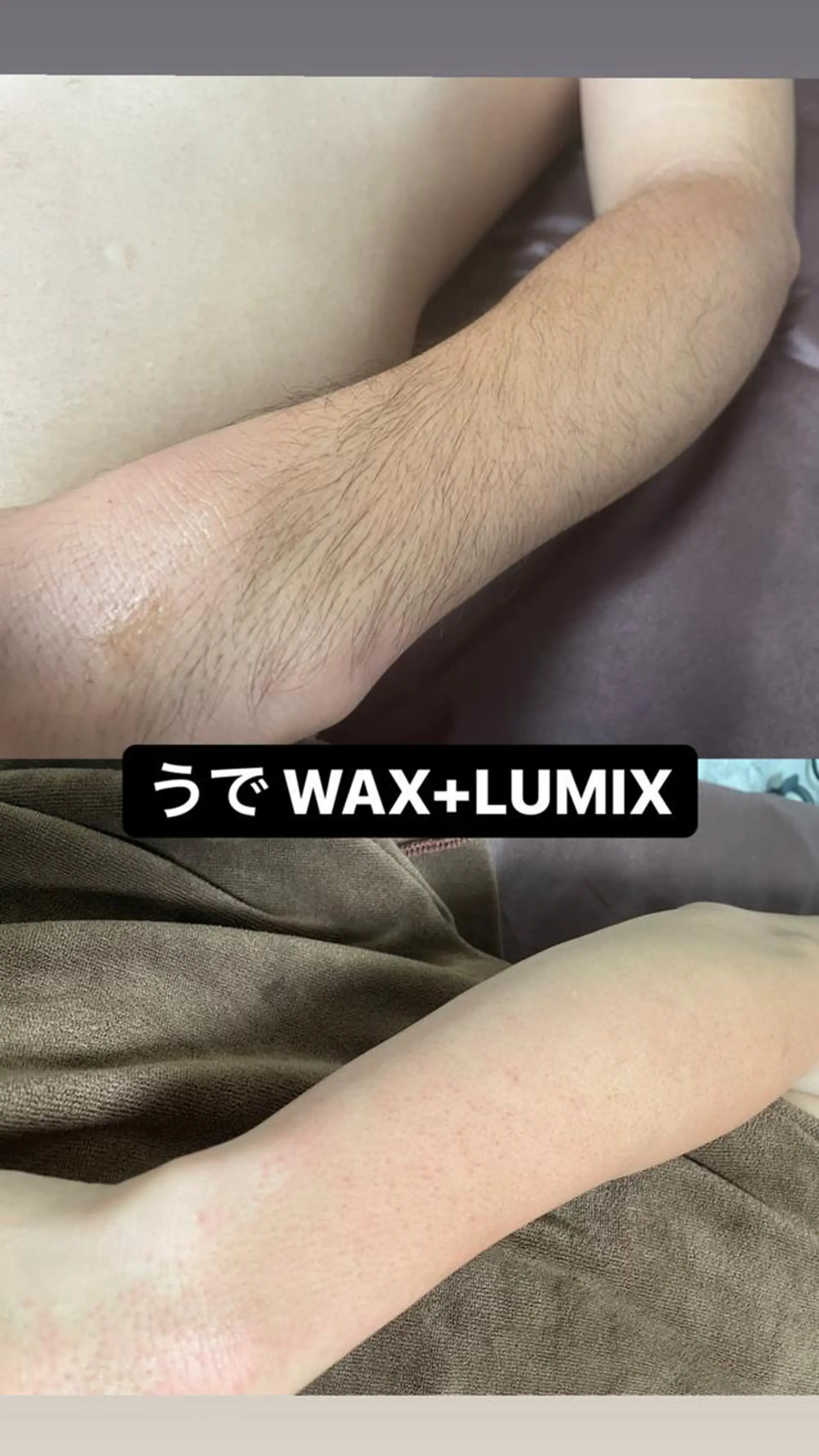 キッズ メンズ 脱毛 Epina 千葉店 【エピナ】のエステ・リラクイメージ