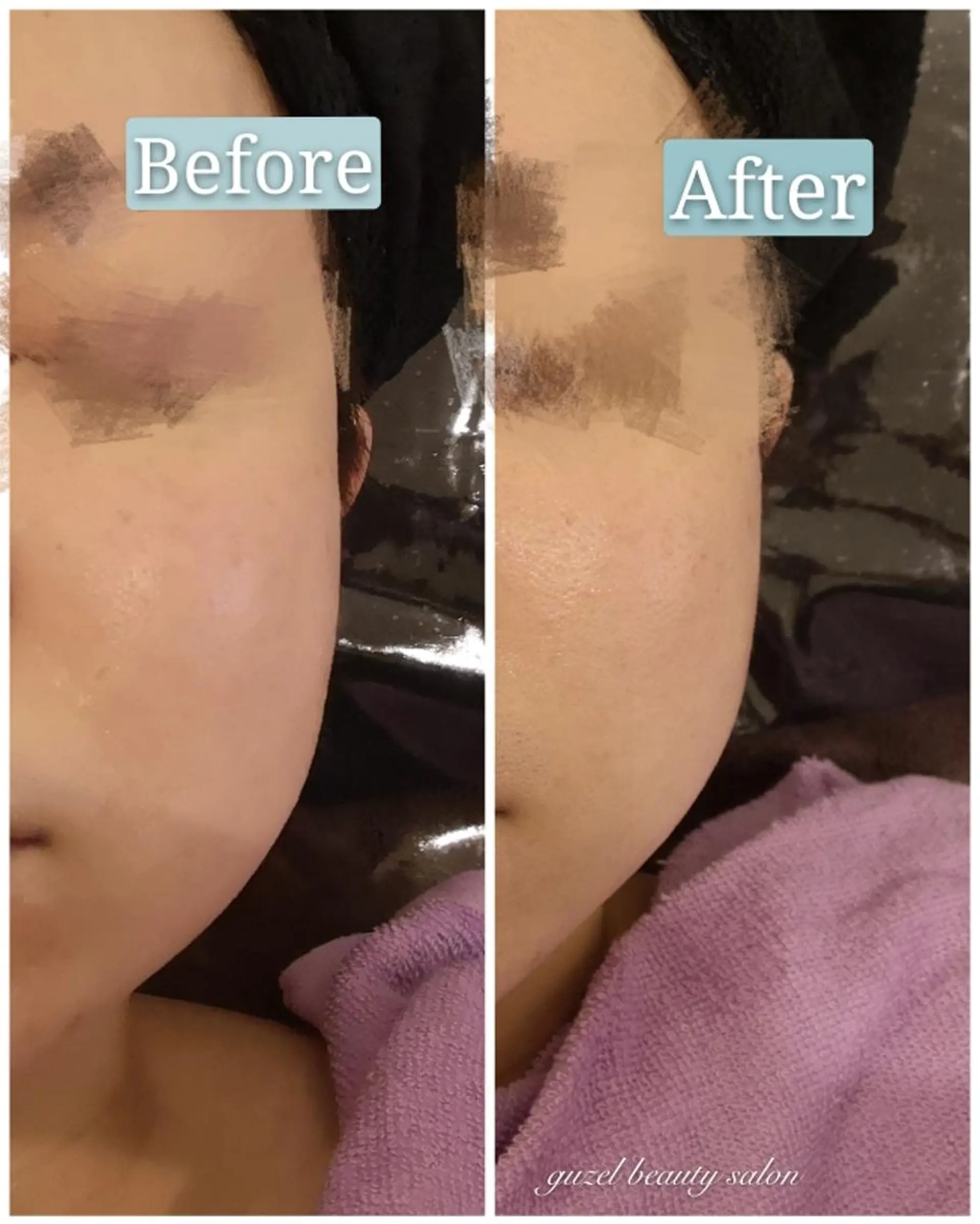 エステ 🅖🅤🅩🅔🅛 salonのエステ・リラクイメージ