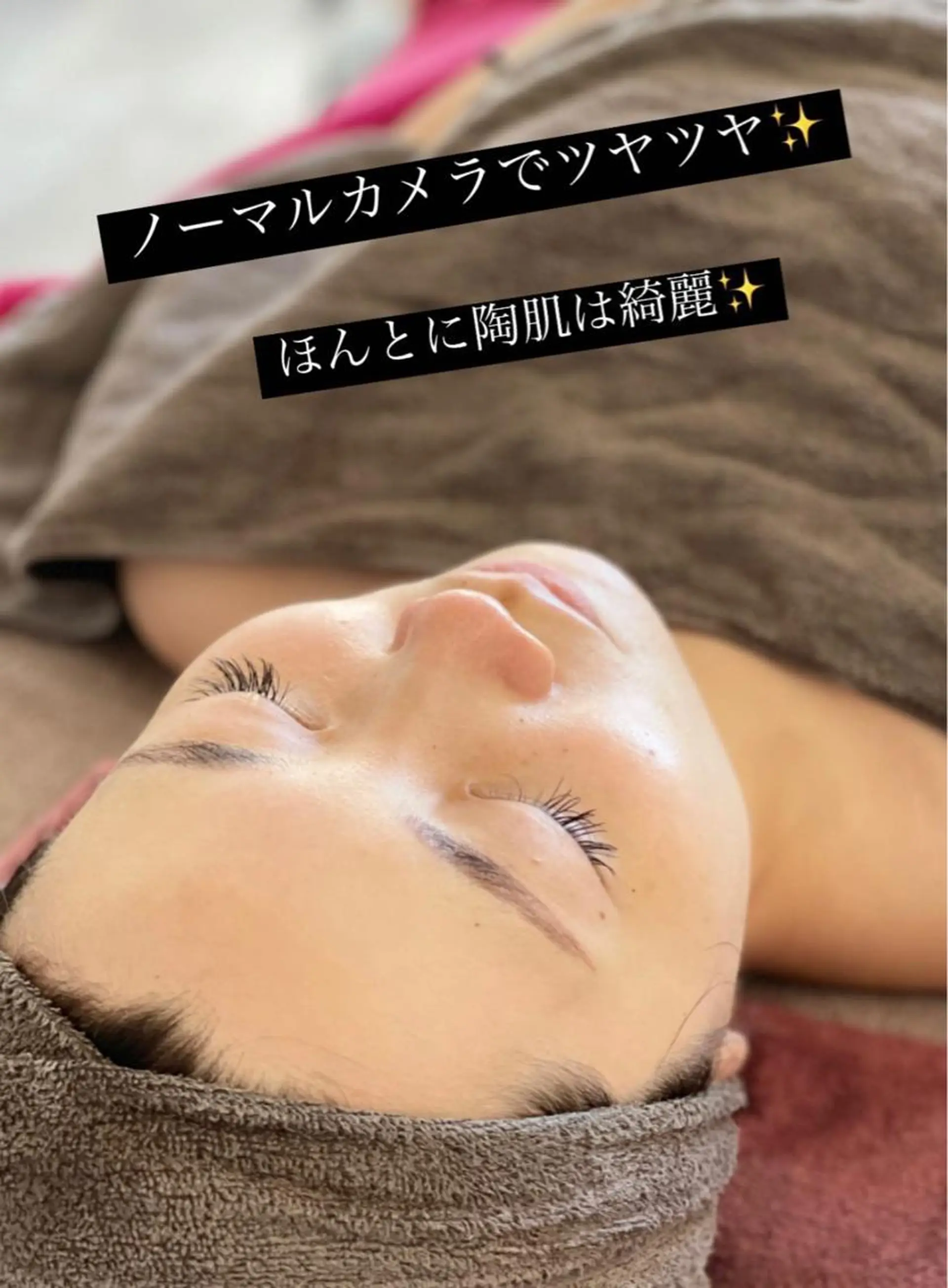 美容鍼サロン    Fleurir所属・伊藤 かなえのエステ・リラクイメージ