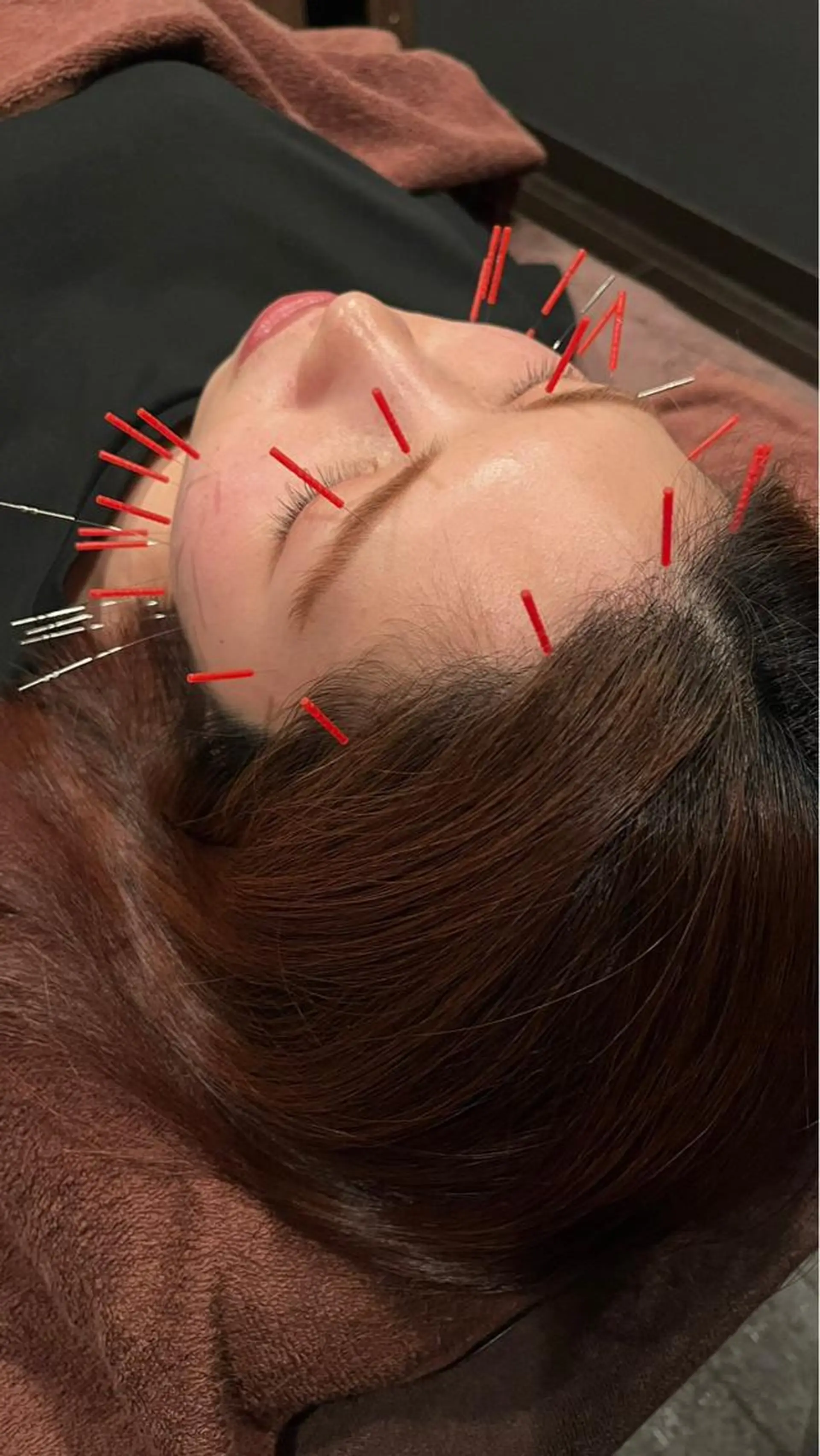 小林整骨院玉川 キジマのエステ・リラクイメージ