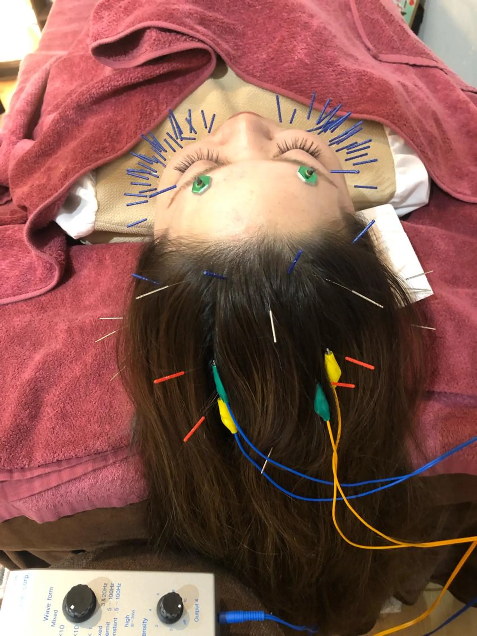 エステ リラク 美容鍼灸女性専用 りんご鍼灸治療院のエステ・リラクイメージ