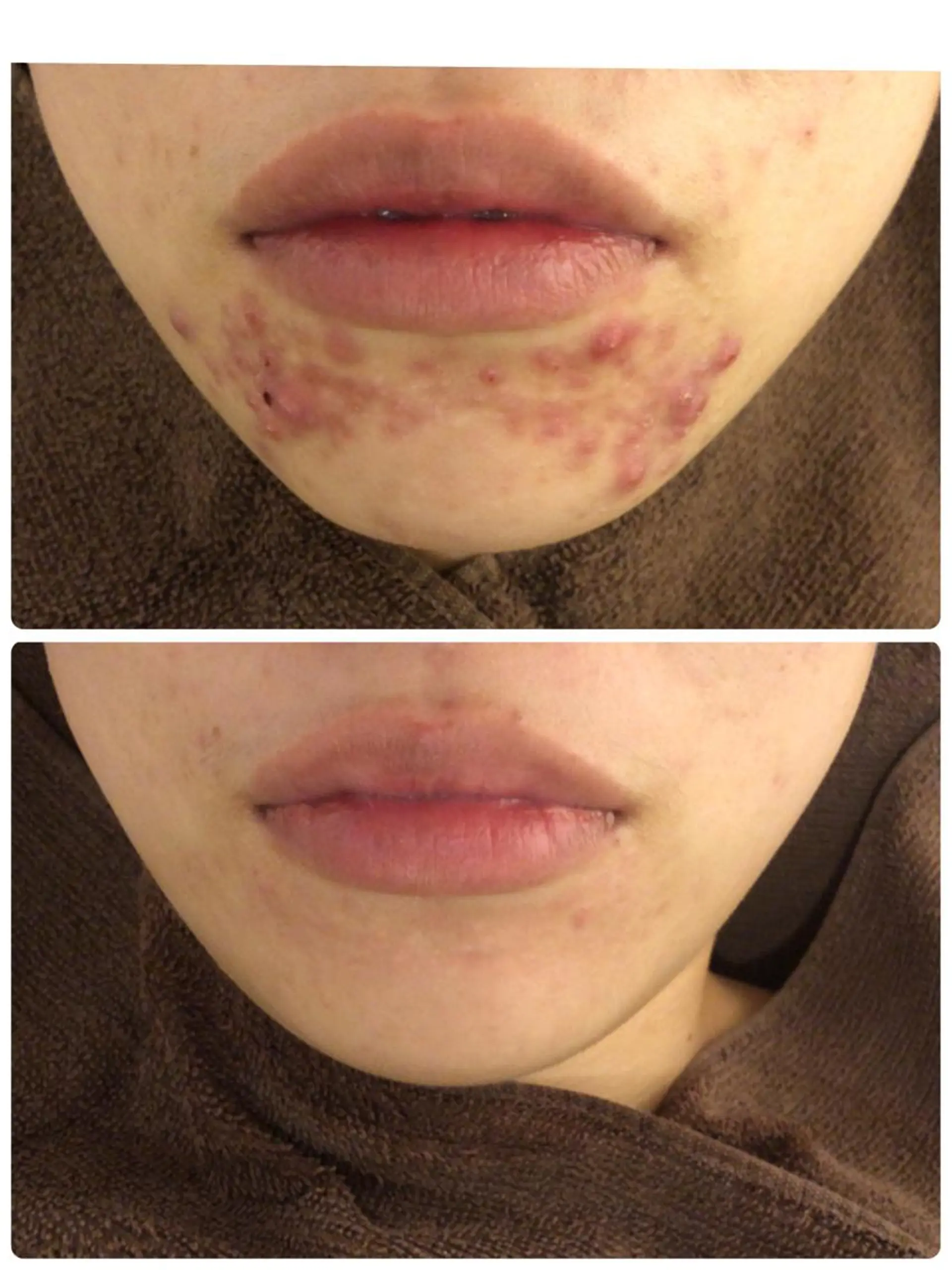 ミディアム カラー パーマ ヘアアレンジ メンズ キッズ ネイル マツエク・マツパ エステ リラク ニキビ・肌質改善専門 ♡人生が変わるサロンのエステ・リラクイメージ