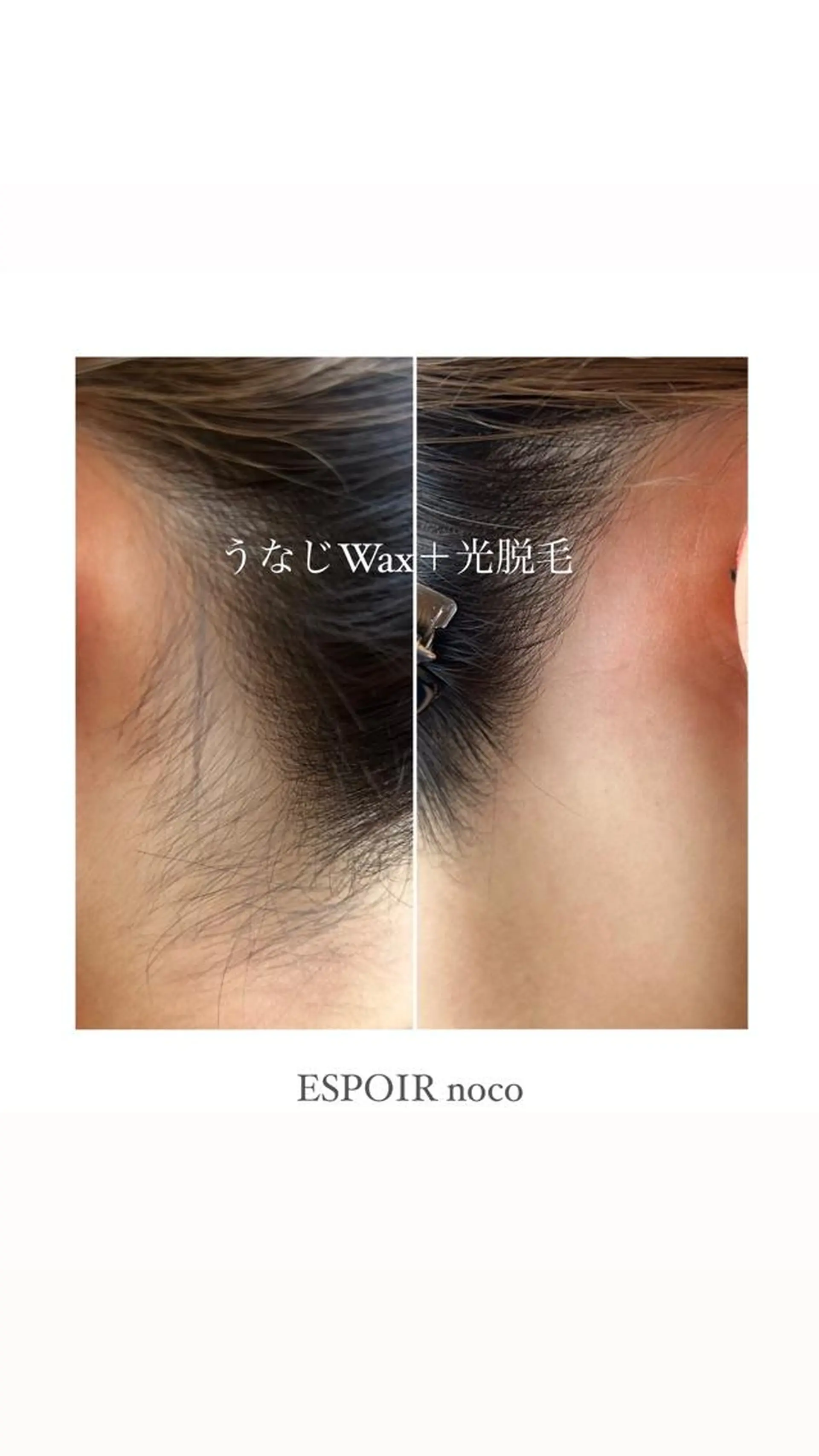 ワックス脱毛🌈 ESPOIRnocoのエステ・リラクイメージ