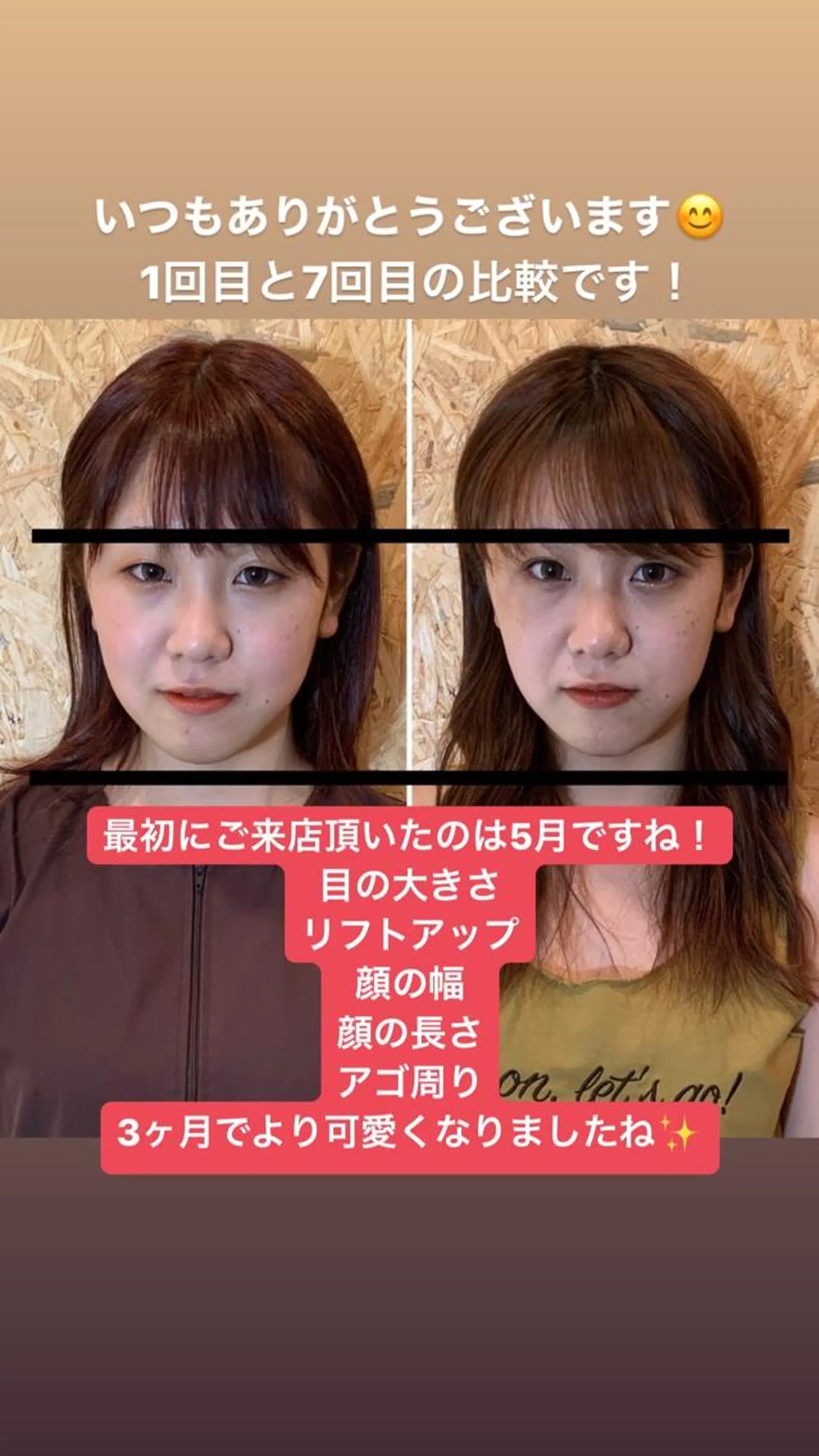 エステ リラク 小顔×小顔×小顔 おくむらサロン所属・耳ツボジュエリー 3000円のエステ・リラクイメージ