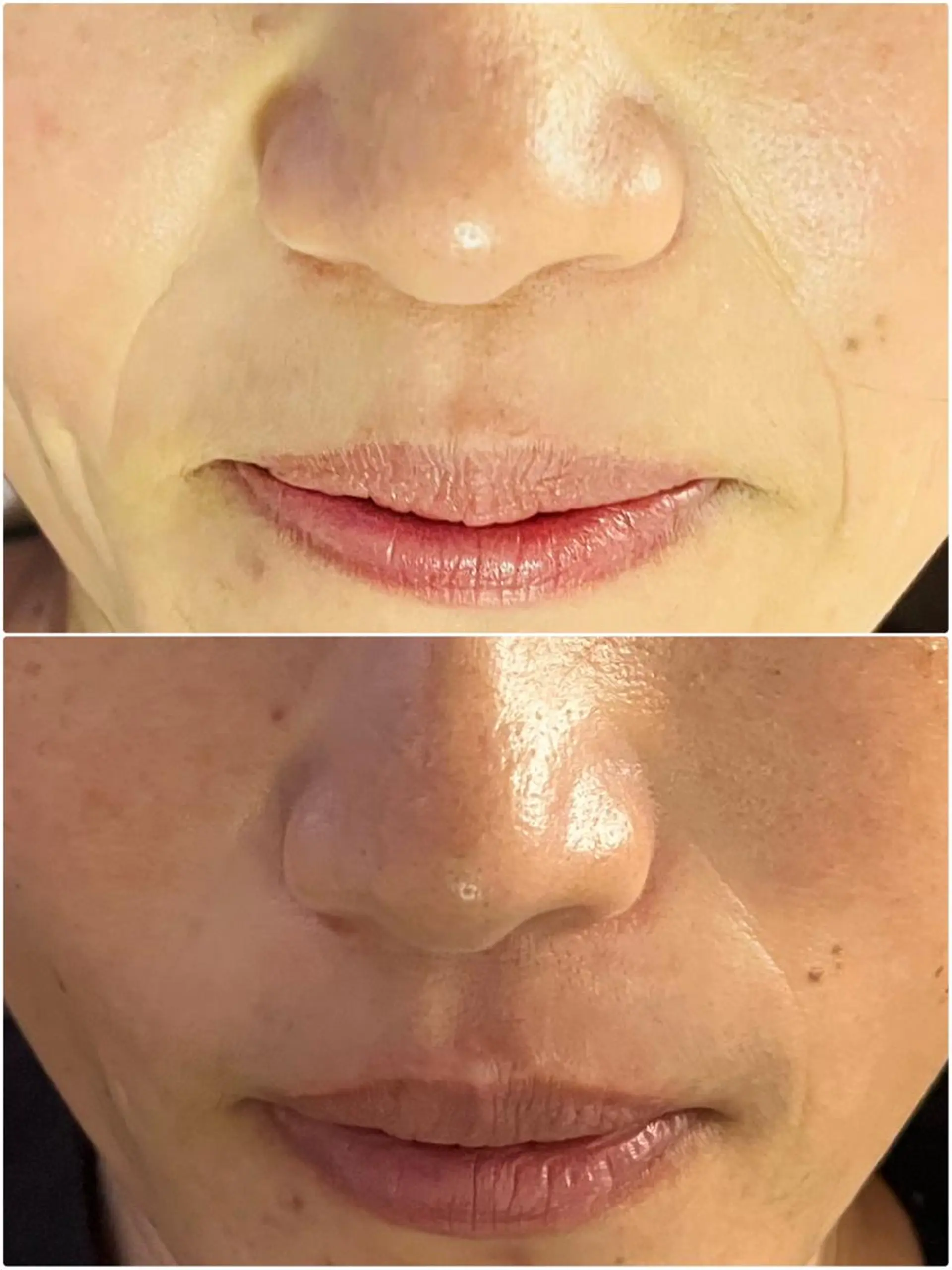 アロマ･美容鍼･カッ ピング「麗」鍼灸院のエステ・リラクイメージ