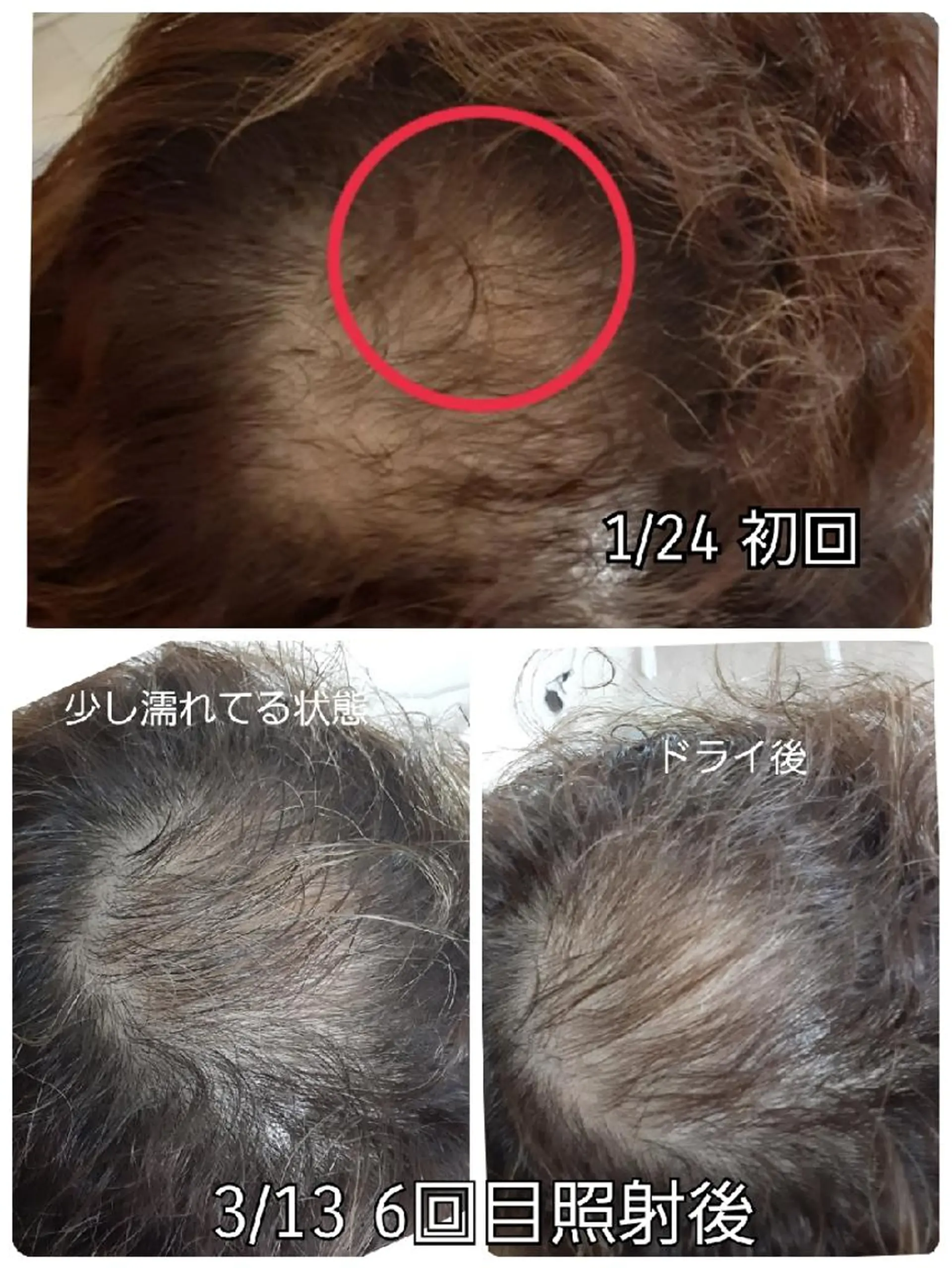 五十嵐 蓮のその他イメージ