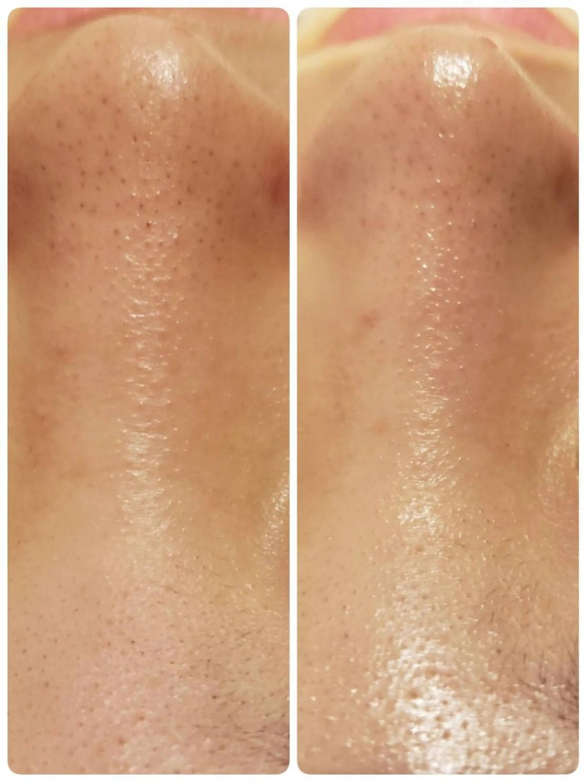 エステ 【リベルハーブピーリング認定店】敏感肌・美白脱毛専門店Dione立川店所属・Dione 立川店のエステ・リラクイメージ