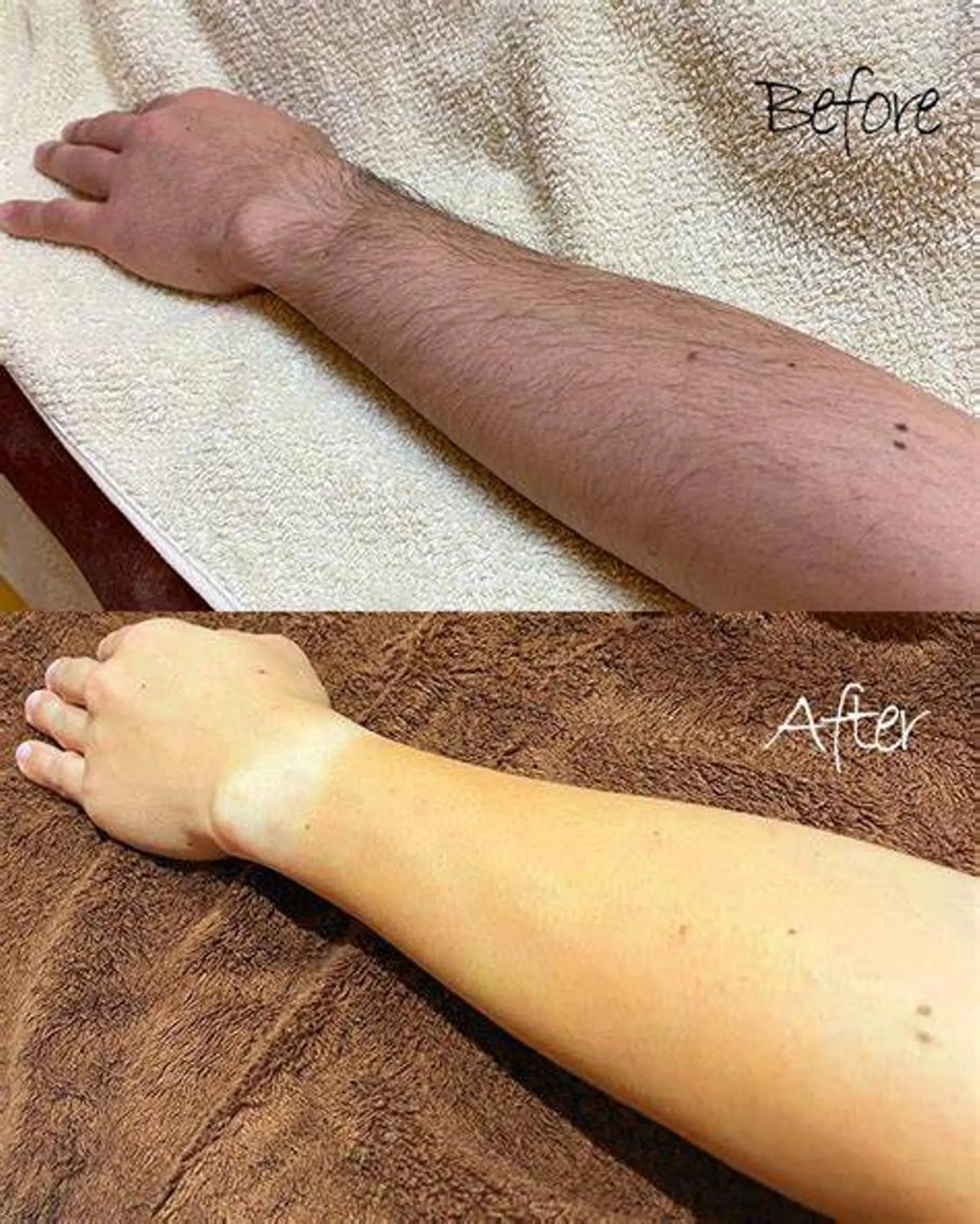 脱毛 脱毛・眉毛・フェイス サロンN久留米店のその他イメージ