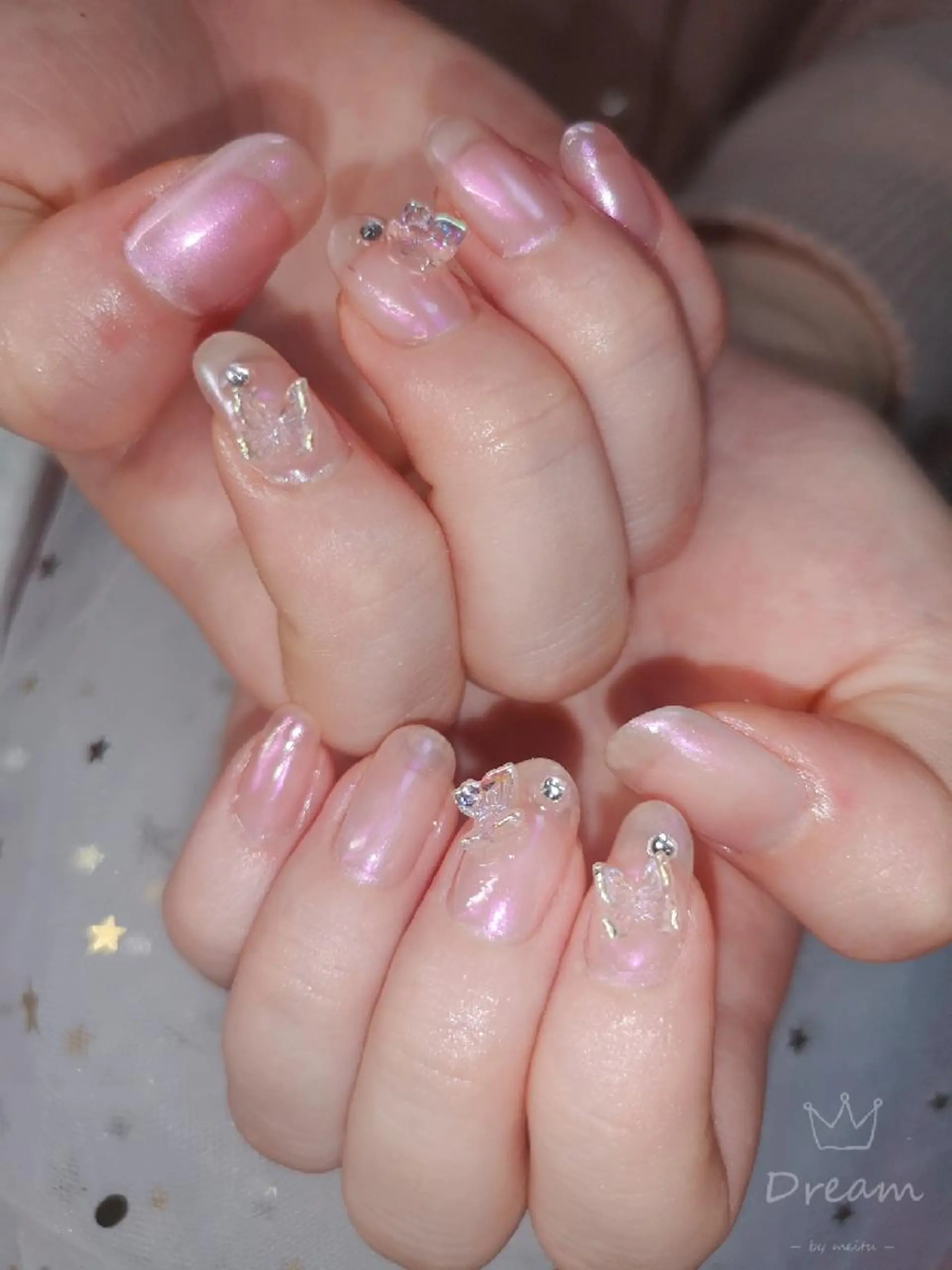 ミディアム ネイル ハンドネイル ネイリストゆか💅 長さだし、深爪矯正のネイルデザイン