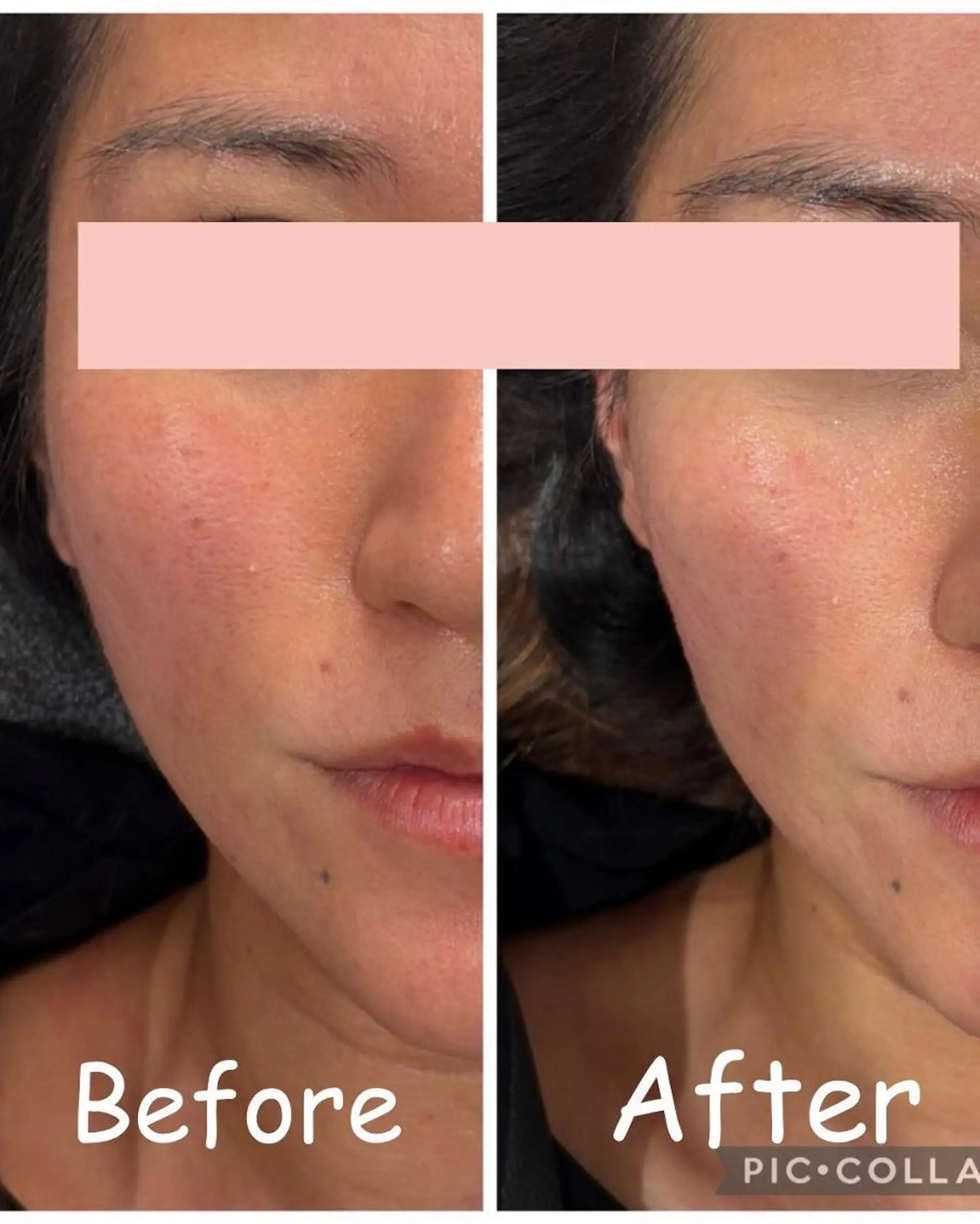 エステ リラク 痩身&小顔矯正専門店 Re:Livesのエステ・リラクイメージ