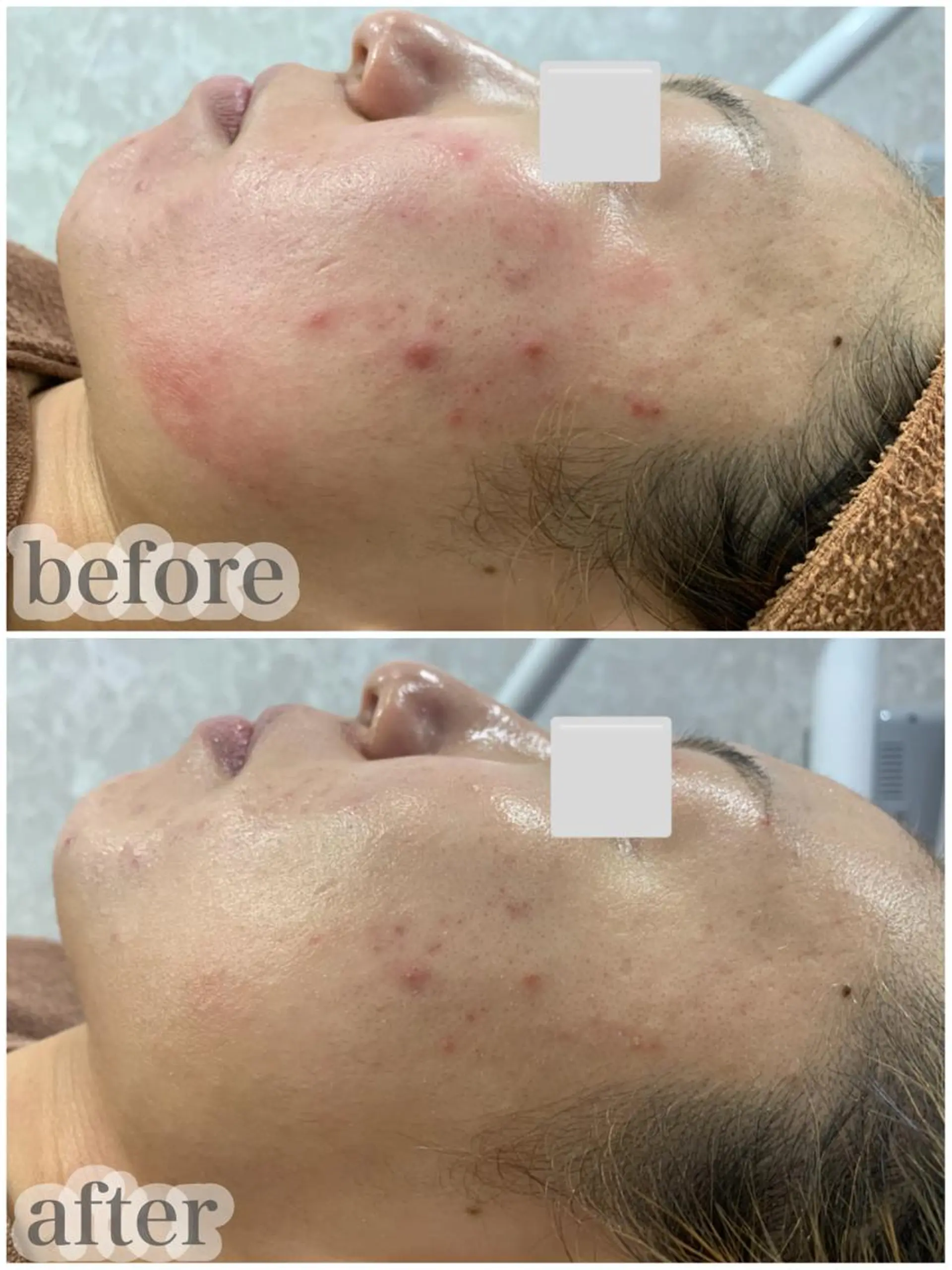 LAGRECE 大阪梅田店のエステ・リラクイメージ