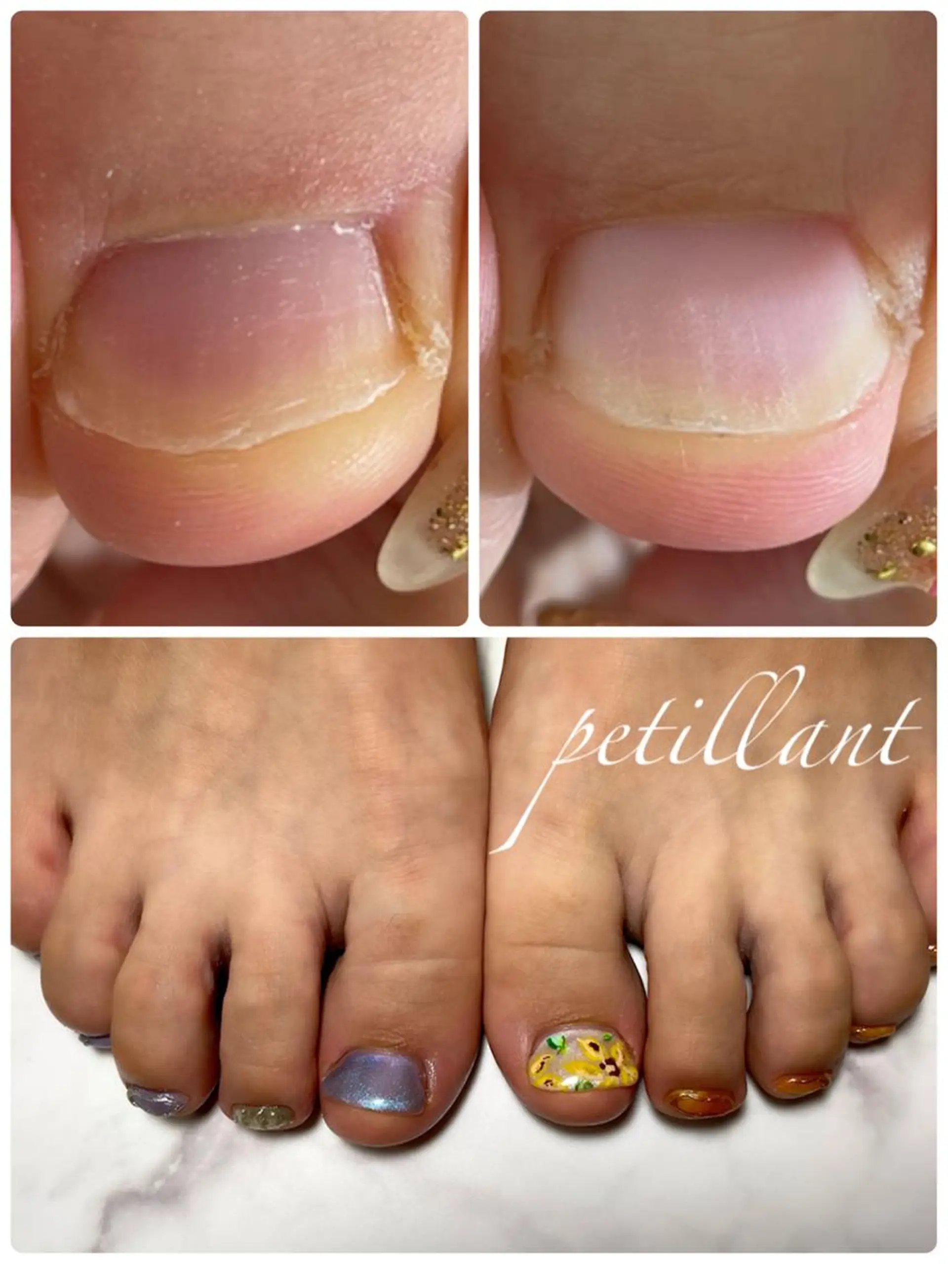 ネイル 長さ出し キラキラネイル ロングネイル フットネイル petillant所属・nail salon petillantのネイルデザイン