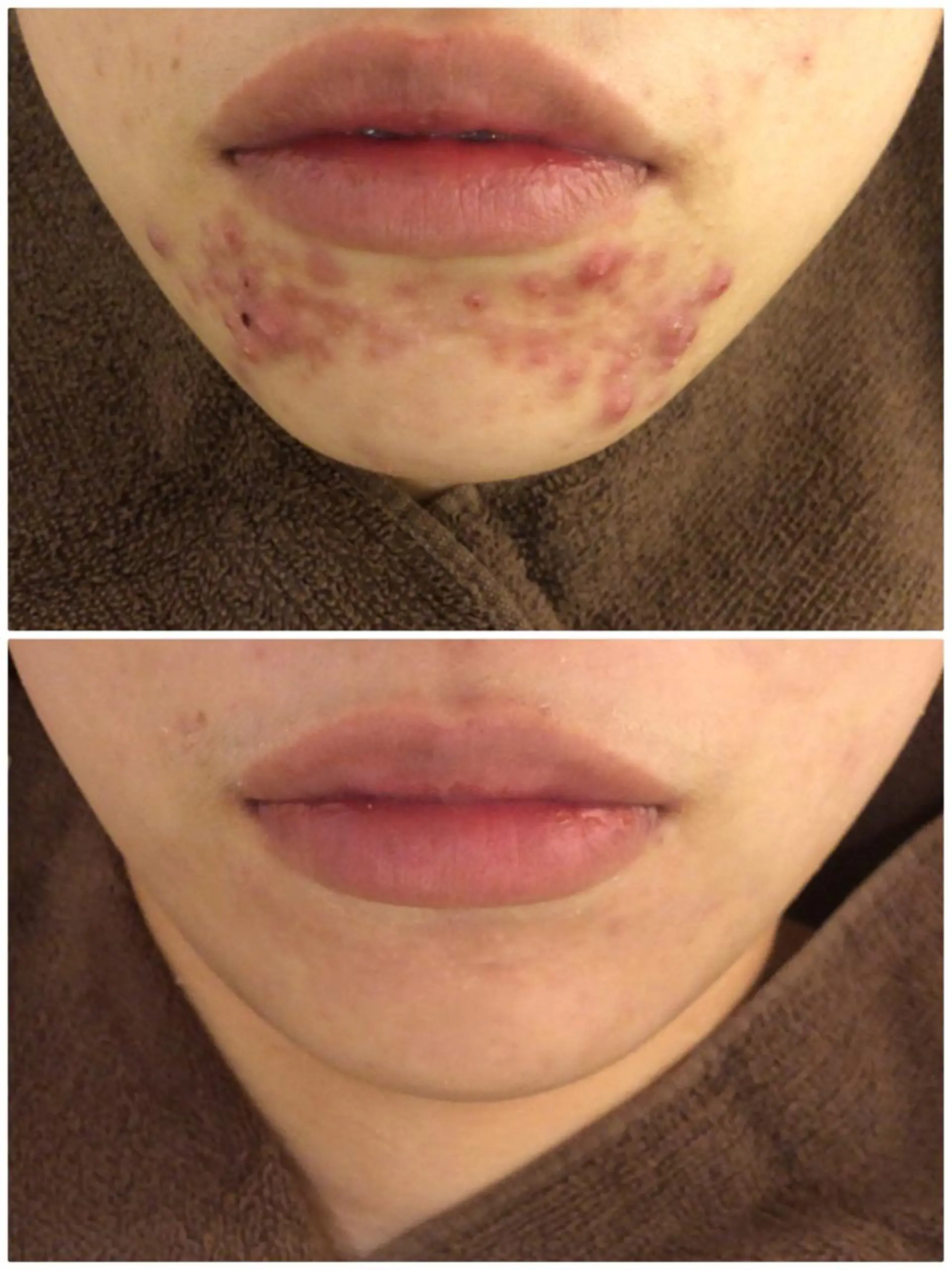 ミディアム カラー パーマ ヘアアレンジ メンズ キッズ ネイル マツエク・マツパ エステ リラク ニキビ・肌質改善専門 ♡人生が変わるサロンのエステ・リラクイメージ