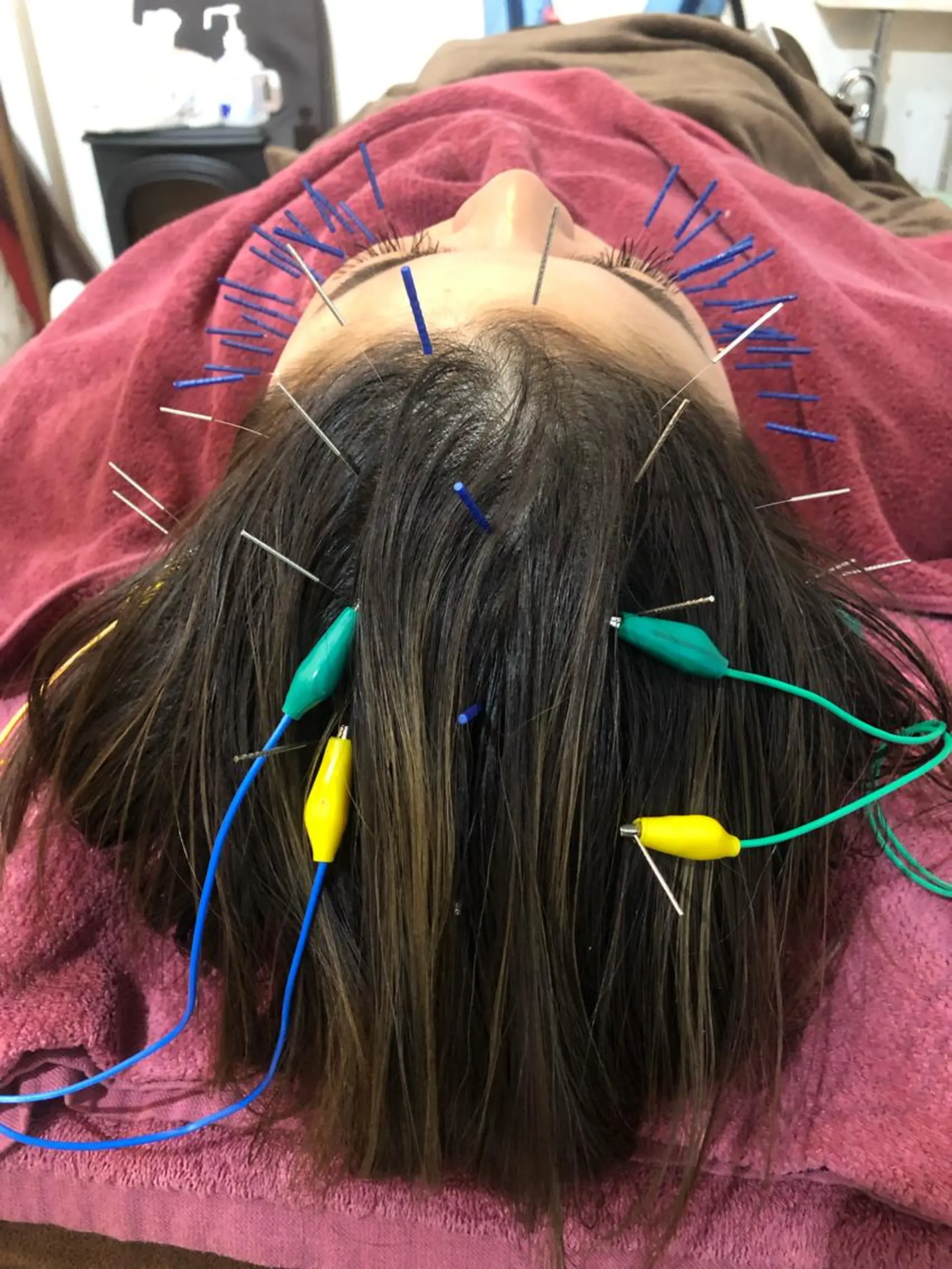 エステ リラク 美容鍼灸女性専用 りんご鍼灸治療院のエステ・リラクイメージ