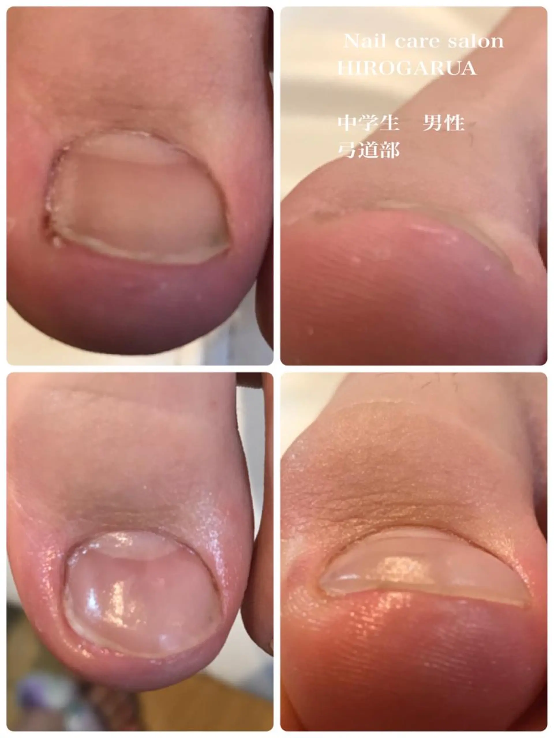 ネイル 冨澤 ひろみのネイルデザイン