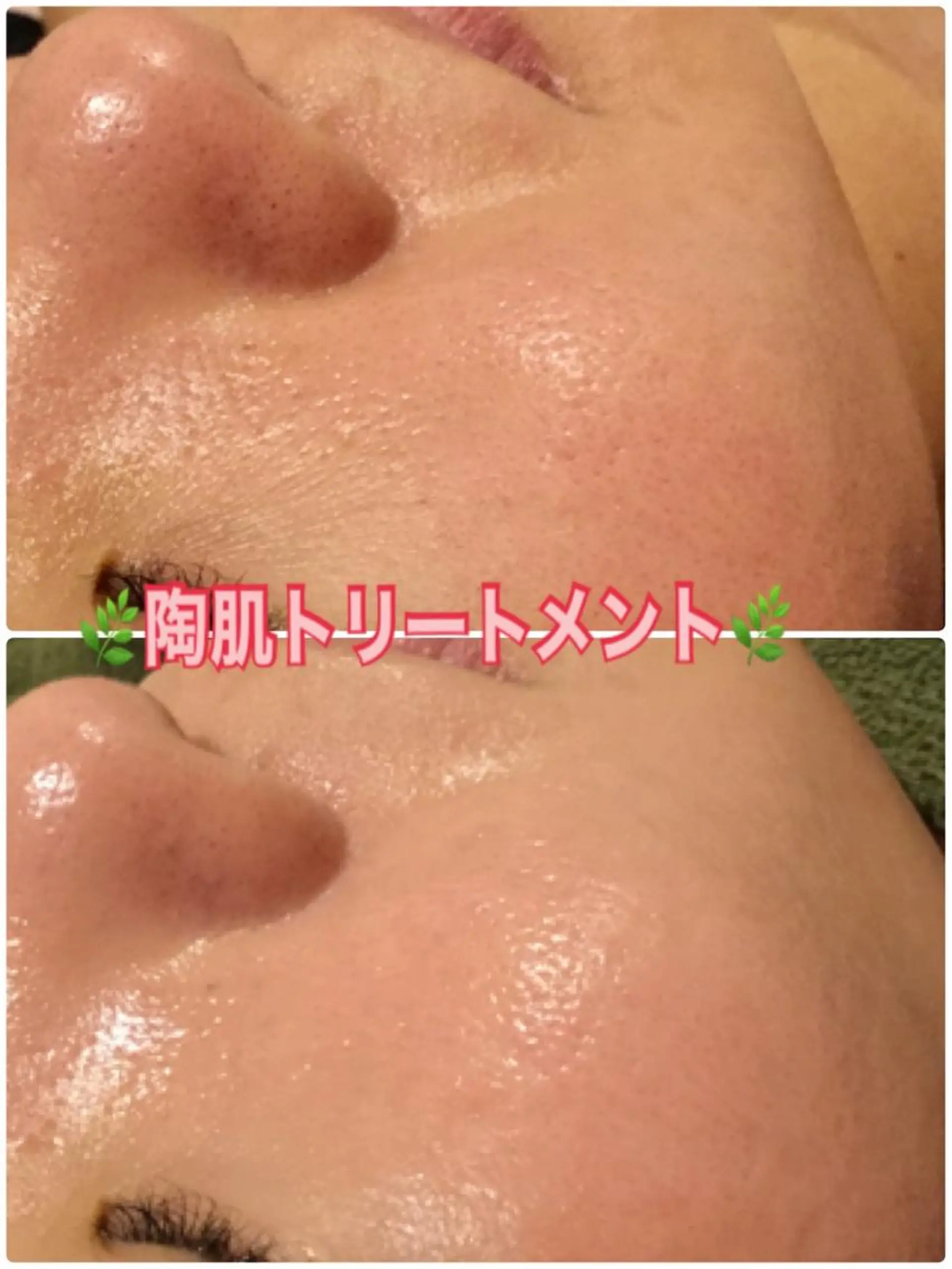 エステ 【リベルハーブピーリング認定店】敏感肌・美白脱毛専門店Dione立川店所属・Dione 立川店のエステ・リラクイメージ