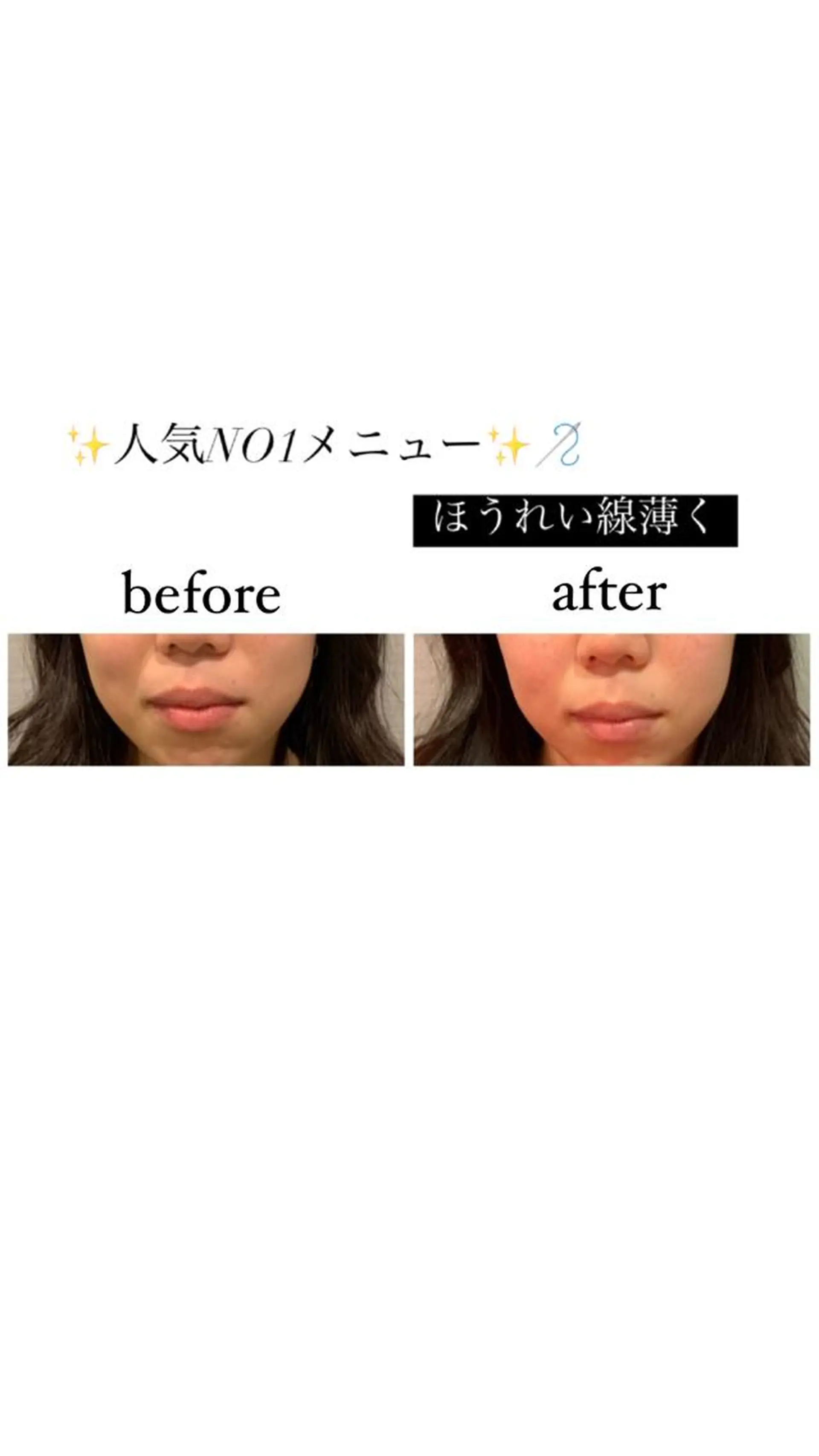 エステ リラク 種市 貴子のその他イメージ