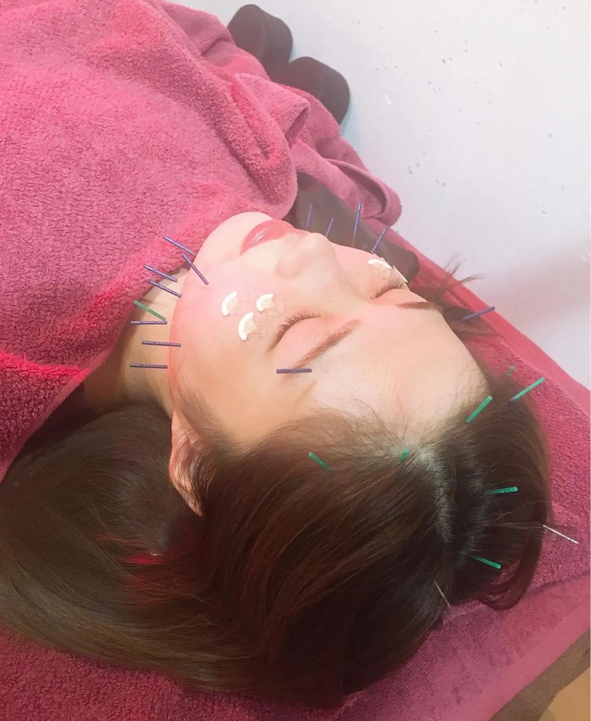 美容鍼灸女性専用 りんご鍼灸治療院のエステ・リラクイメージ