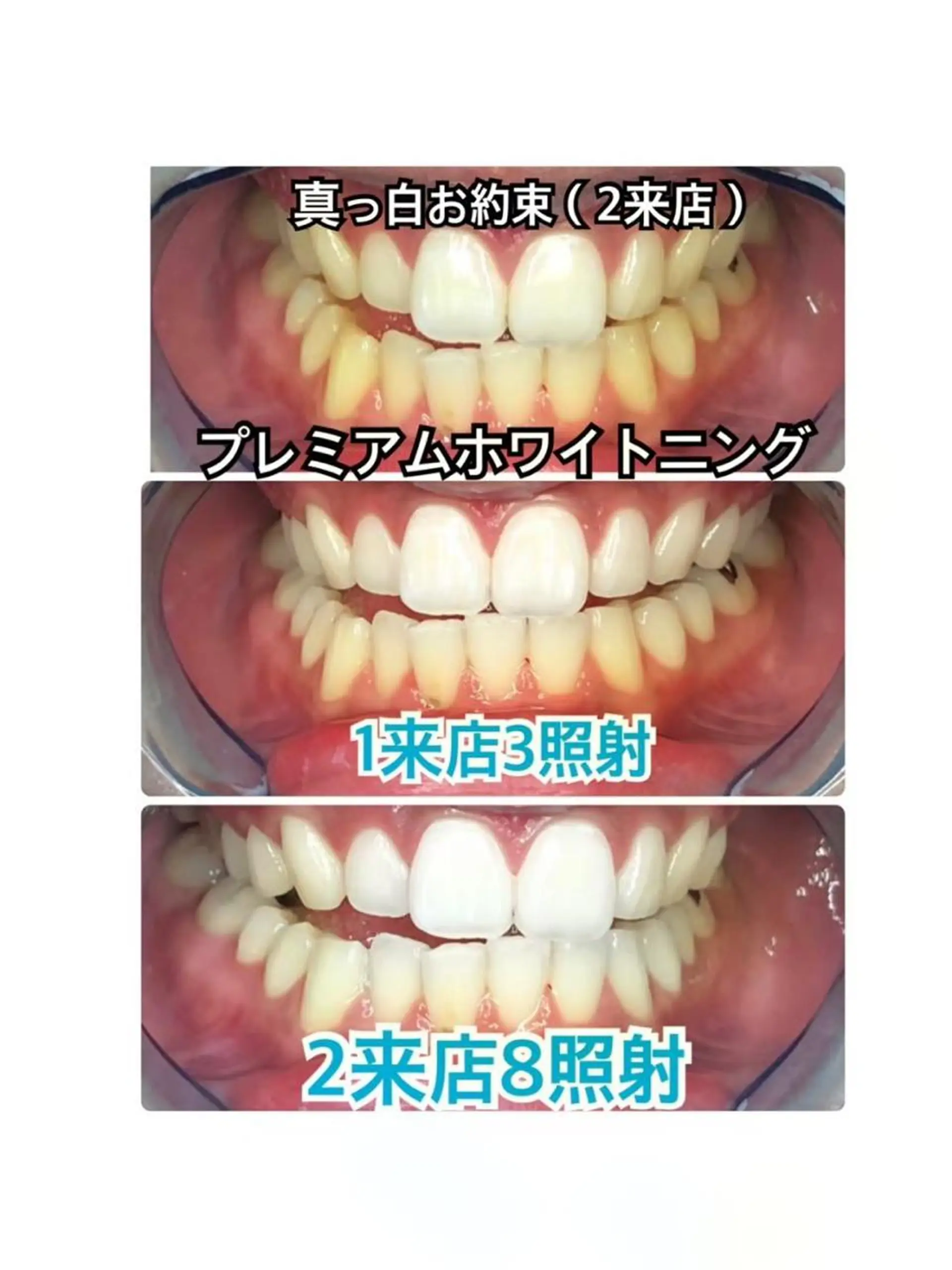 その他 ライトビューティー 恵比寿店のその他イメージ