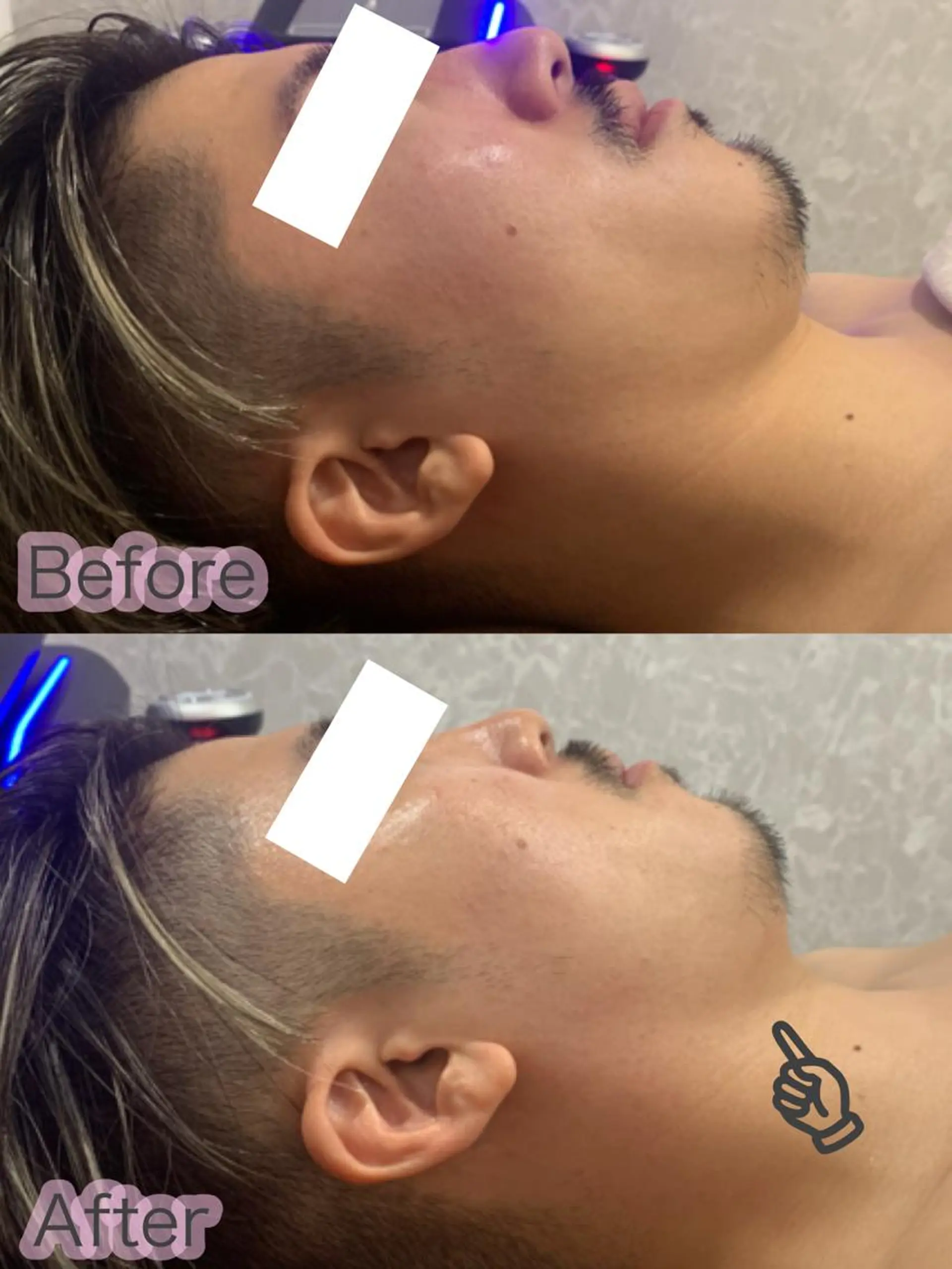 LAGRECE 大阪梅田店のエステ・リラクイメージ