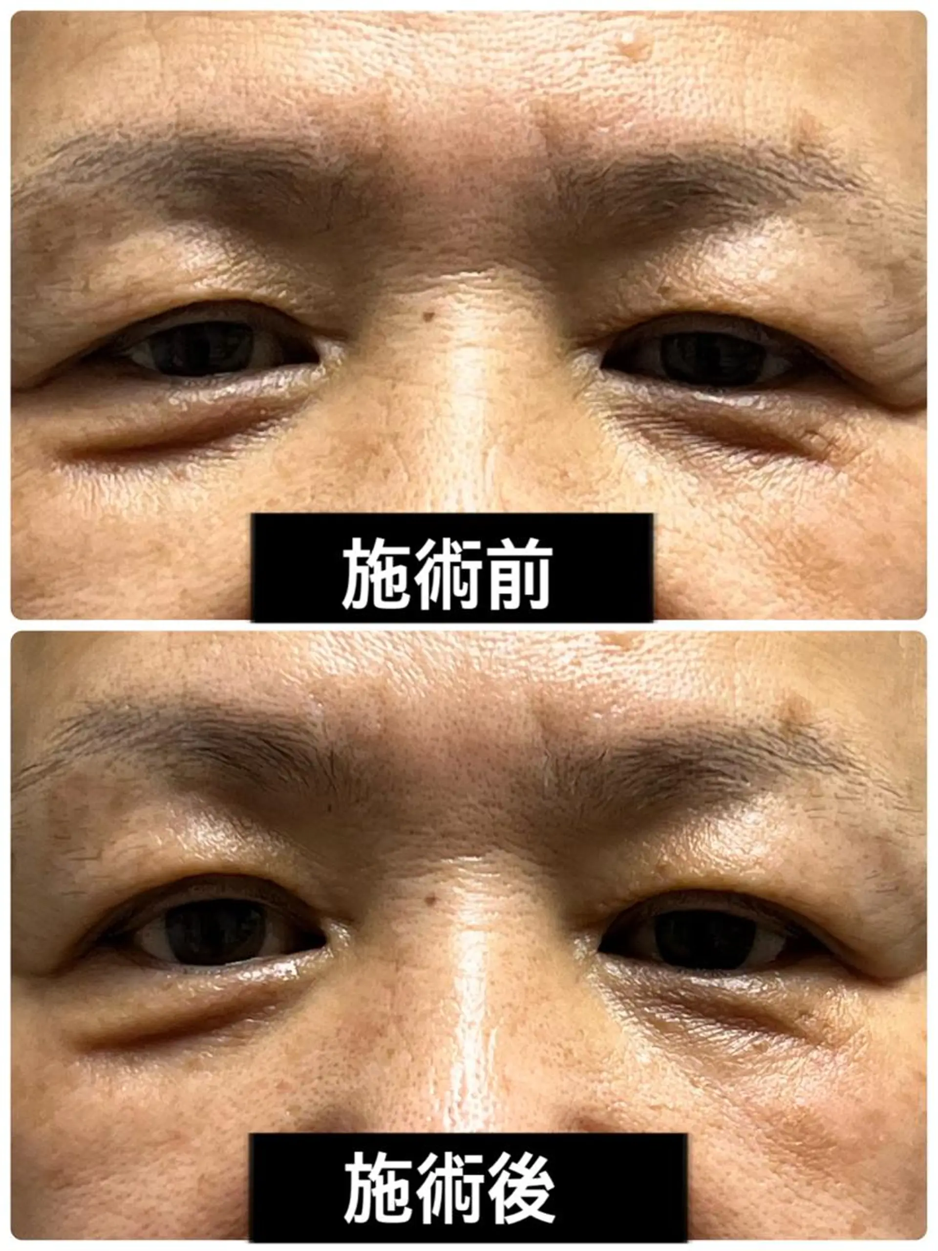 エステ 小顔と腸の専門店 ラクーラビューティのエステ・リラクイメージ