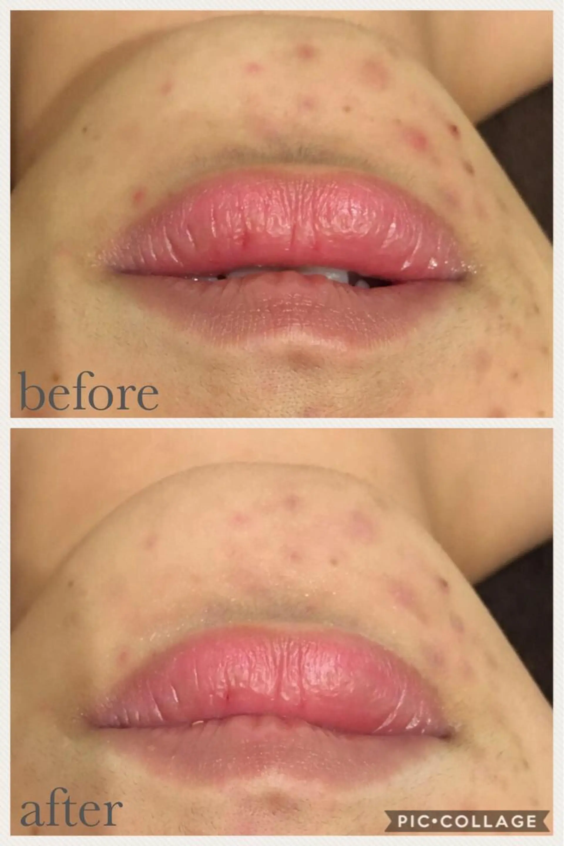 ミディアム カラー パーマ ヘアアレンジ メンズ キッズ ネイル マツエク・マツパ ニキビ・肌質改善専門 ♡人生が変わるサロンのエステ・リラクイメージ