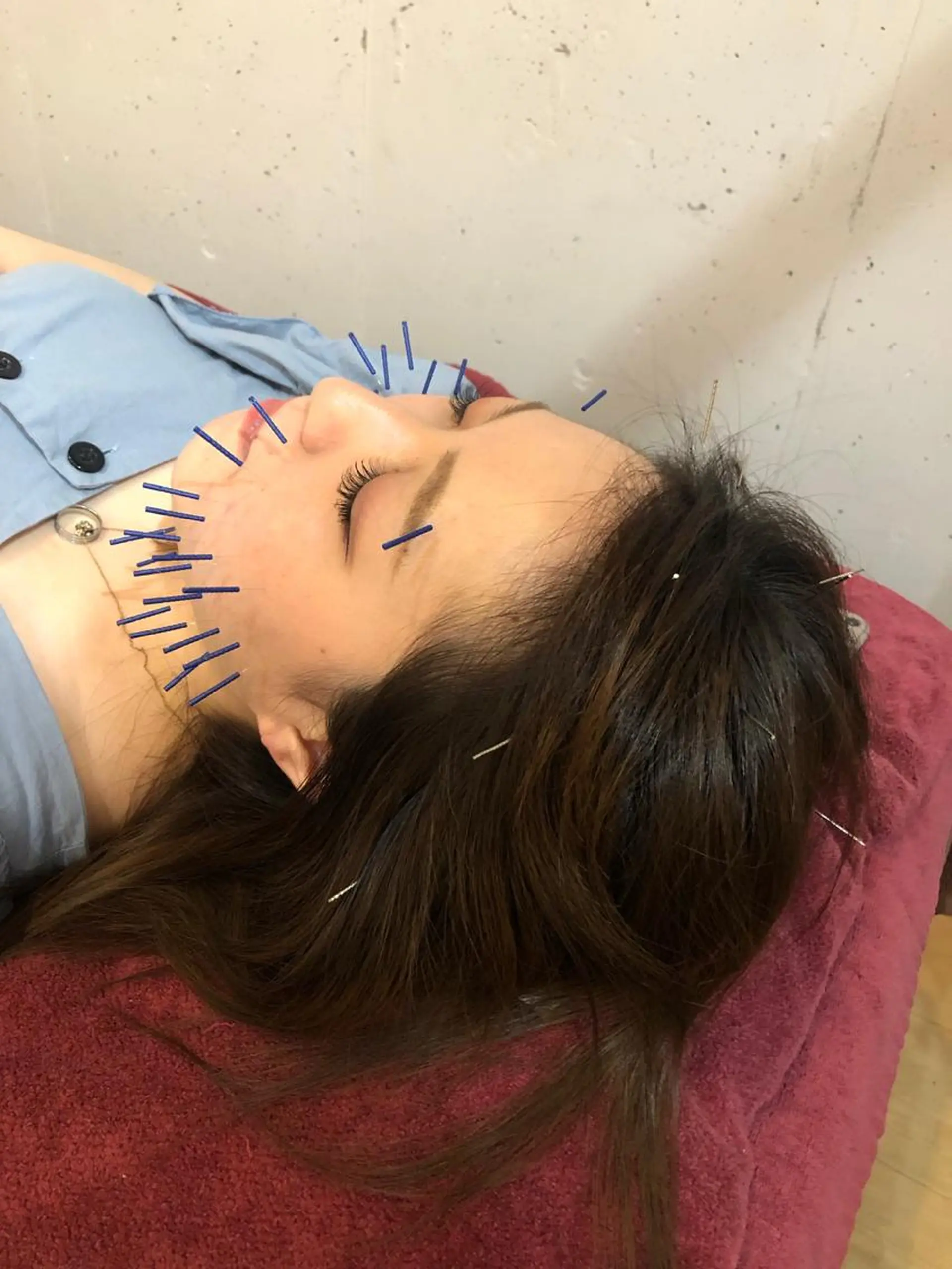 エステ リラク 美容鍼灸女性専用 りんご鍼灸治療院のエステ・リラクイメージ