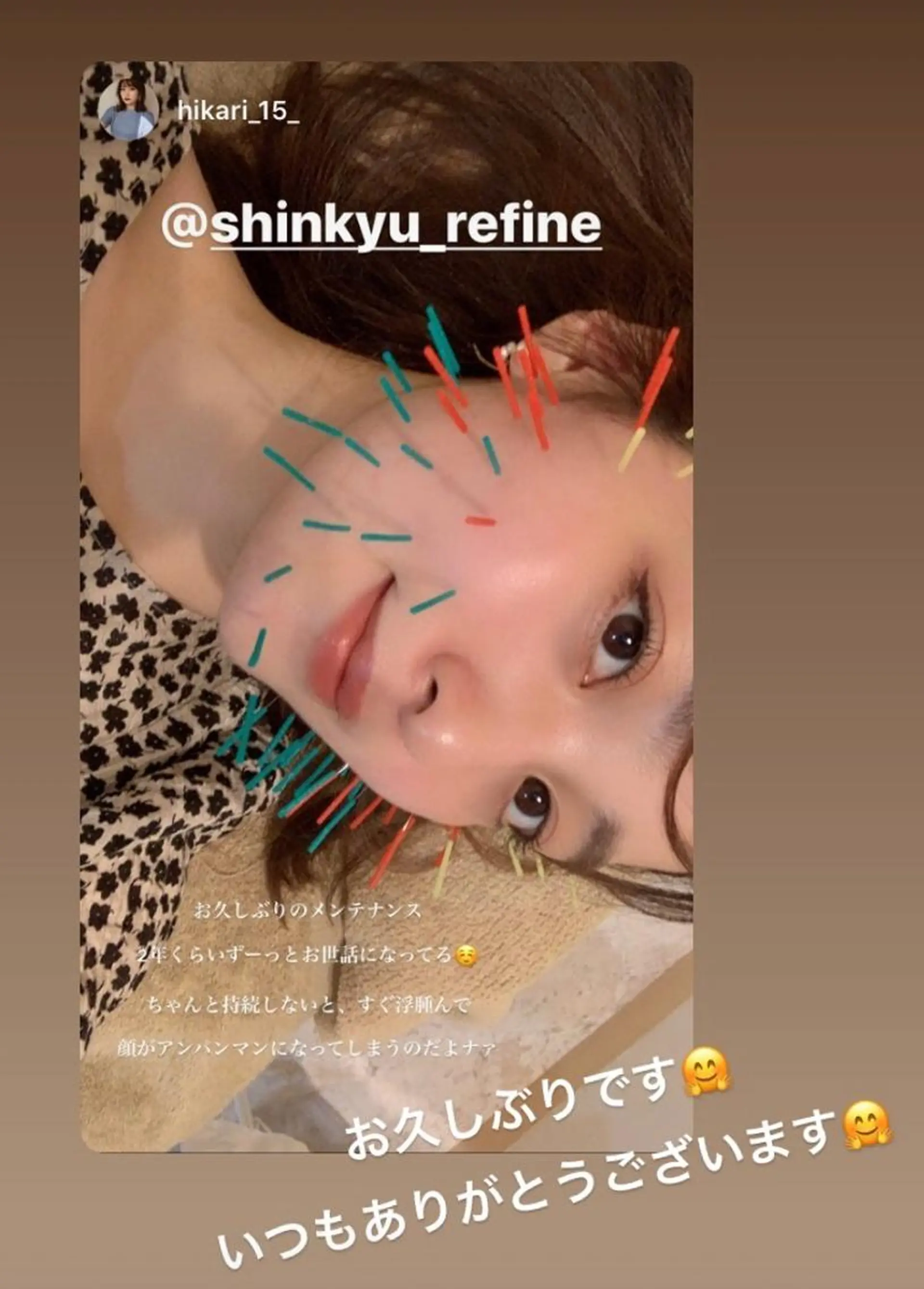 鍼灸整骨院Refine所属・鍼灸 Refineのその他イメージ