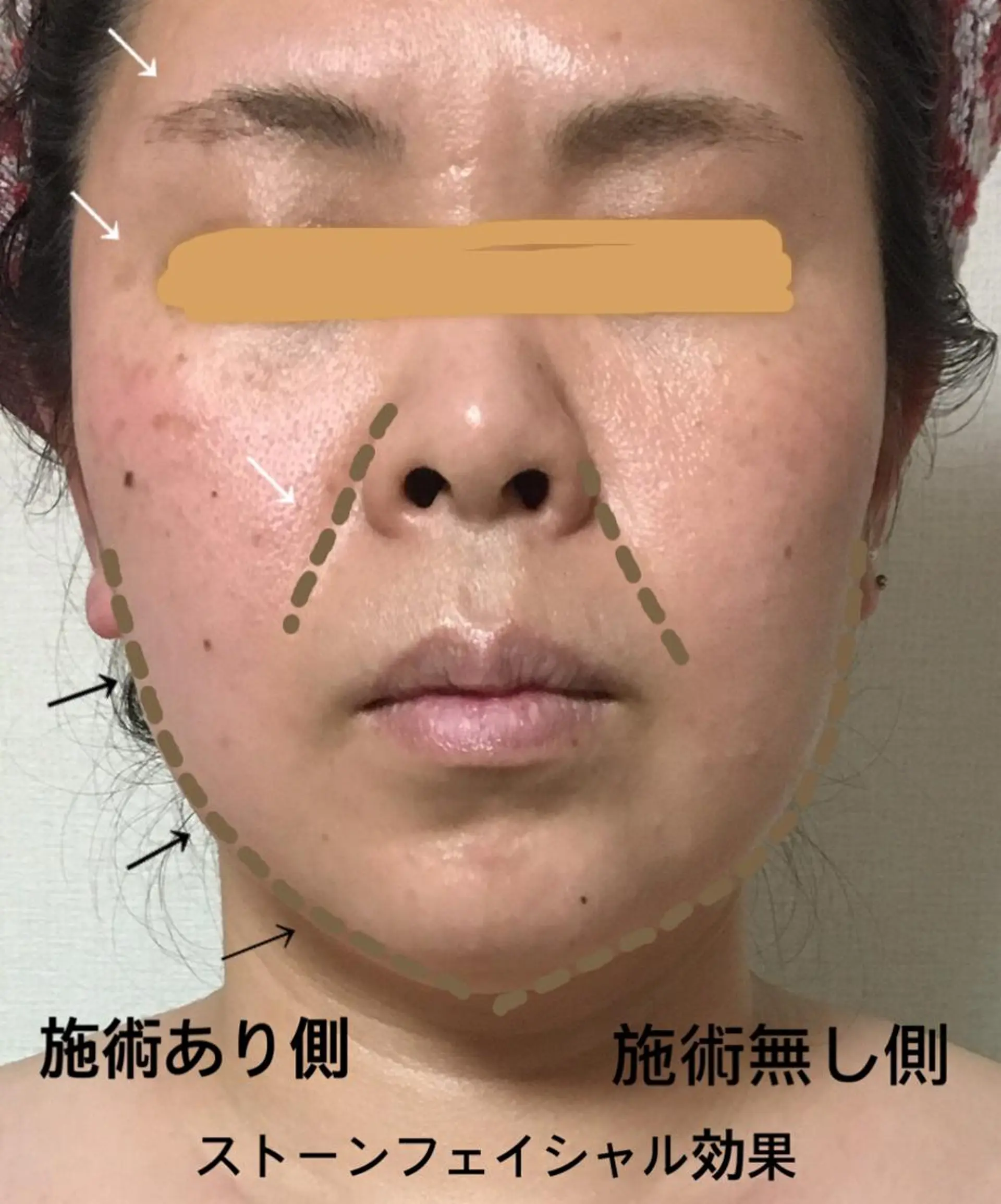 美筋骨格リンパ®️ Aroleのエステ・リラクイメージ